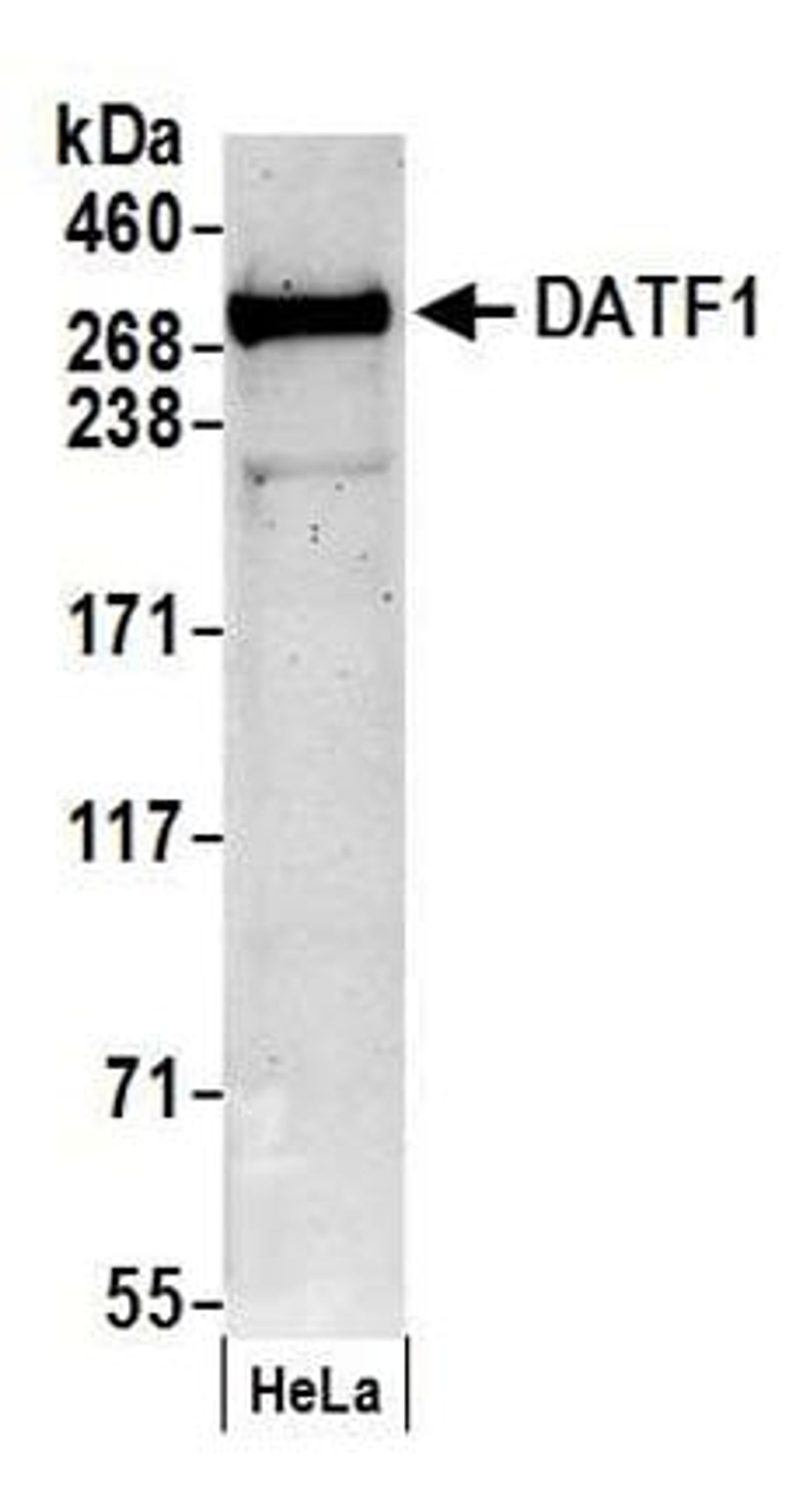 Detection of human DATF1 by western blot.