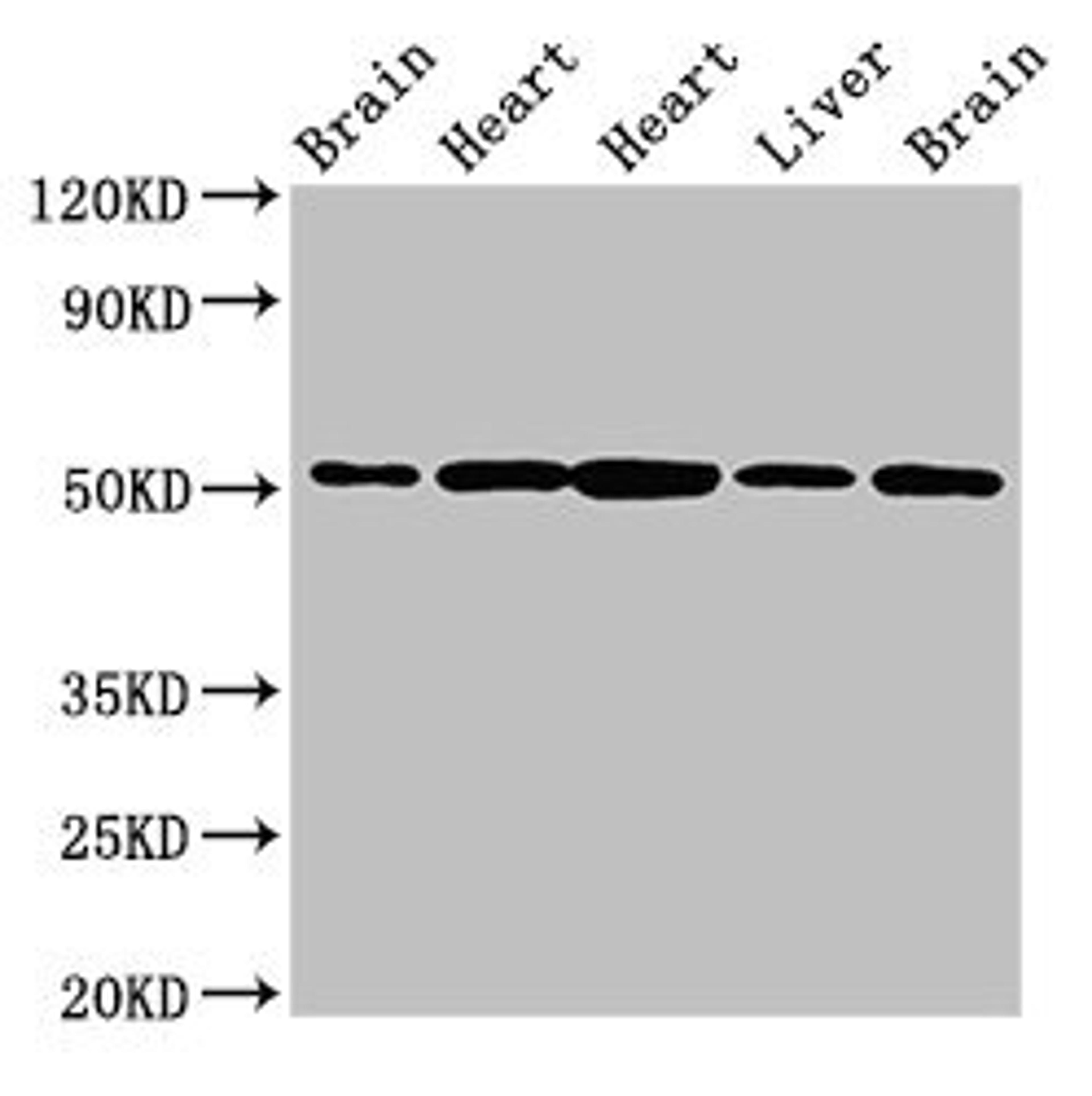 Western Blot. Positive WB detected in: Rat brain tissue, Rat heart tissue, Mouse heart tissue, Mouse liver tissue, Mouse brain tissue. All lanes: NUCB2 antibody at 2.5ug/ml. Secondary. Goat polyclonal to rabbit IgG at 1/50000 dilution. Predicted band size: 51 kDa. Observed band size: 51 kDa.