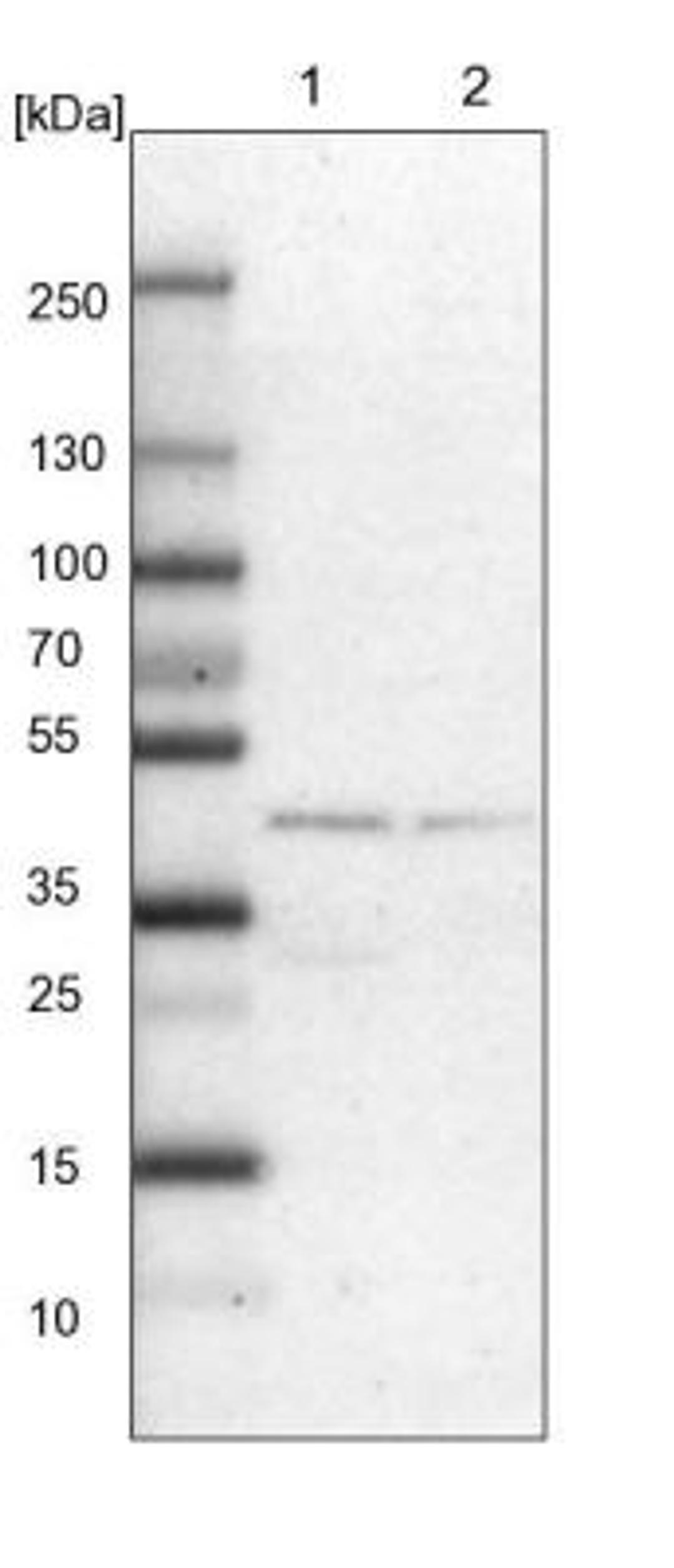 Western Blot: Casein Kinase 1 epsilon Antibody [NBP1-89712] - CSNK1E Antibody [NBP1-89712] - Lane 1: NIH-3T3 cell lysate (Mouse embryonic fibroblast cells)<br/>Lane 2: NBT-II cell lysate (Rat Wistar bladder tumour cells)