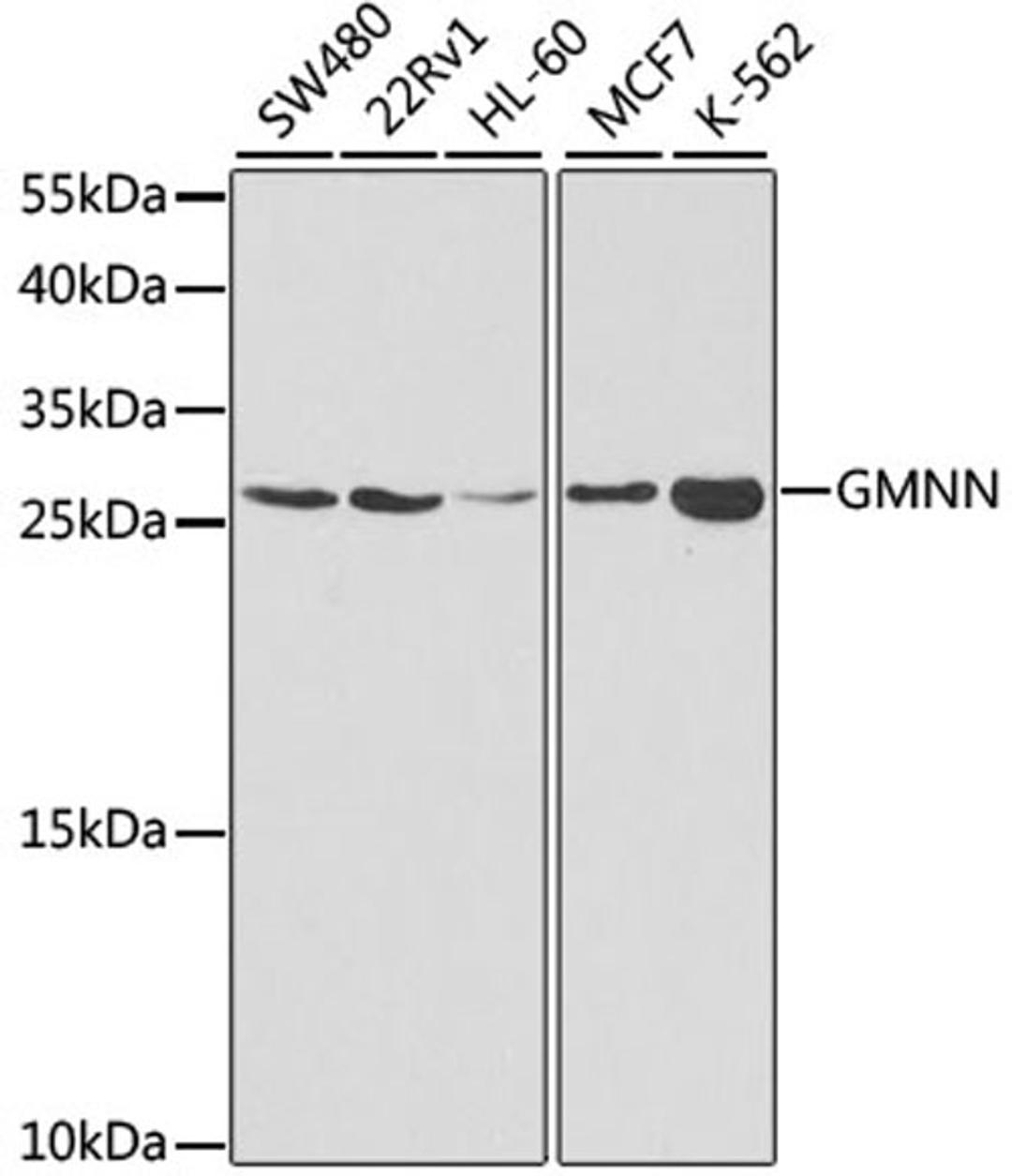 Western blot - GMNN antibody (A5316)