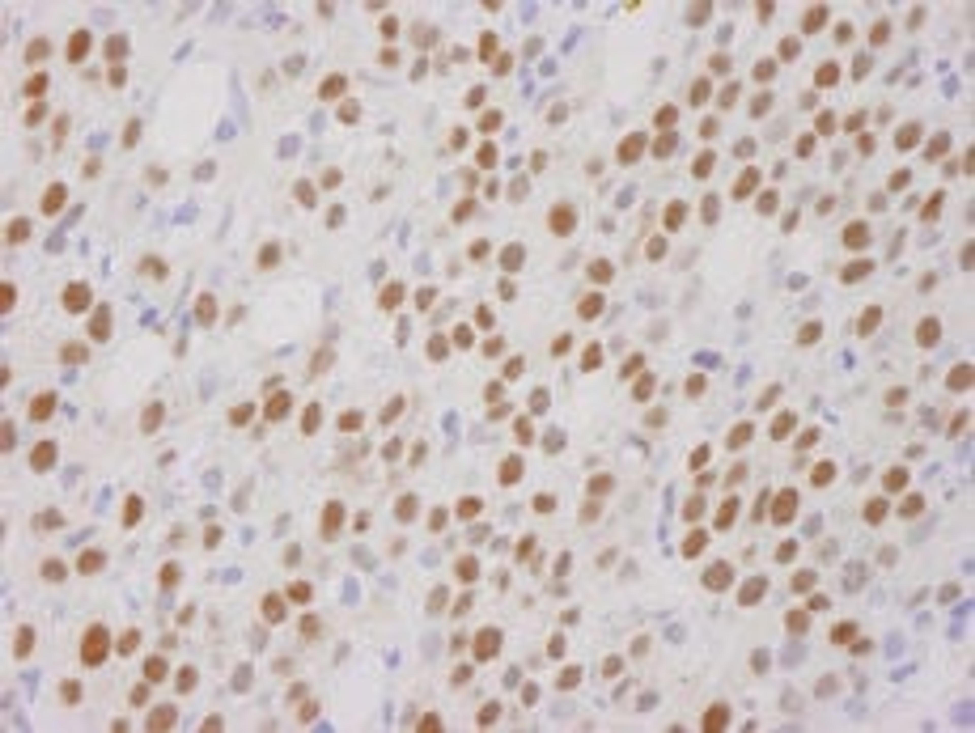 Detection of human CoREST by immunohistochemistry.