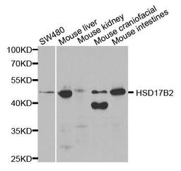 Western blot analysis of extracts of various cell lines using HSD17B2 antibody