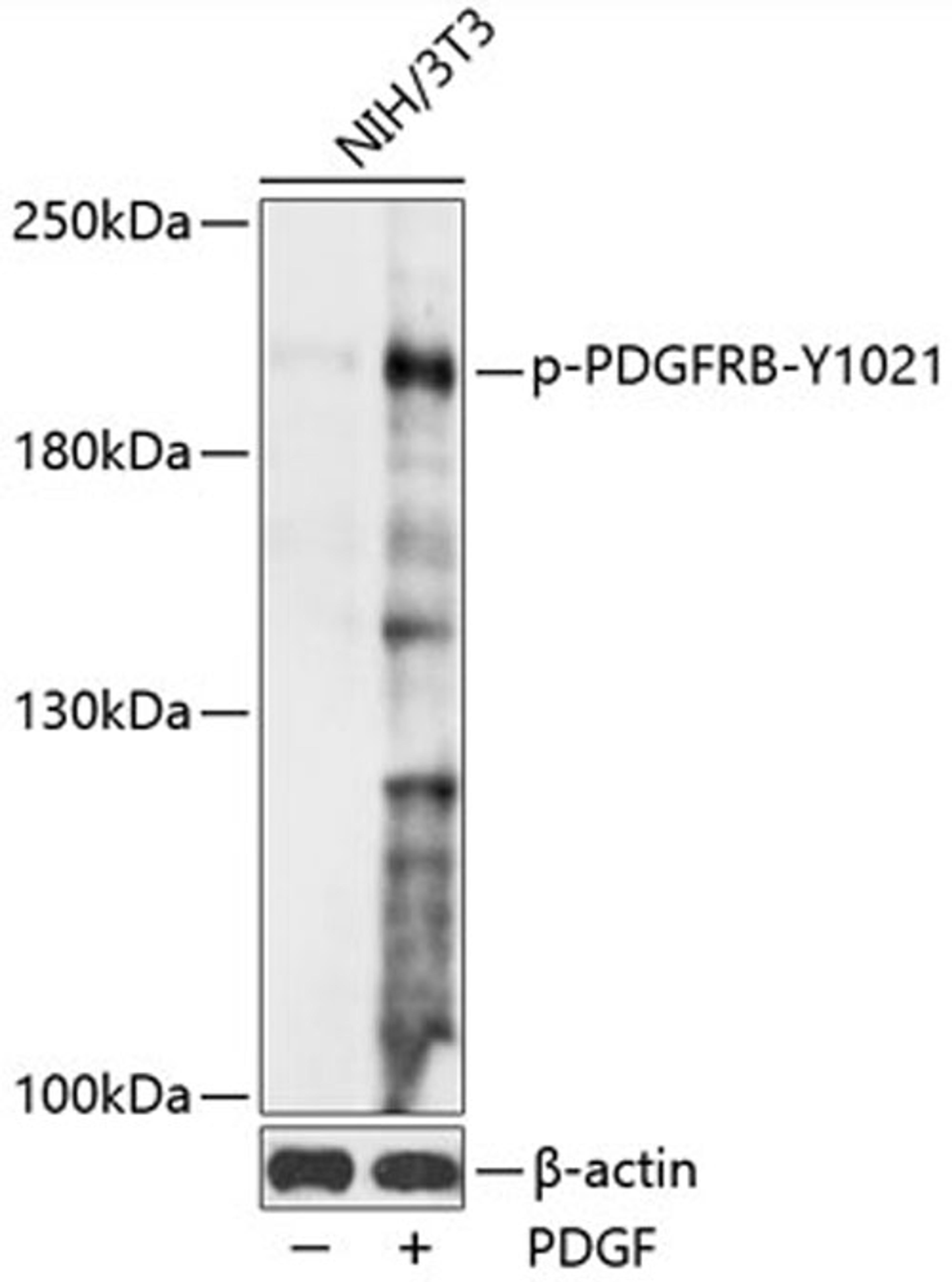 Western blot - Phospho-PDGFRB-Y1021 antibody (AP0815)