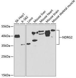 Western blot - NDRG2 antibody (A5319)