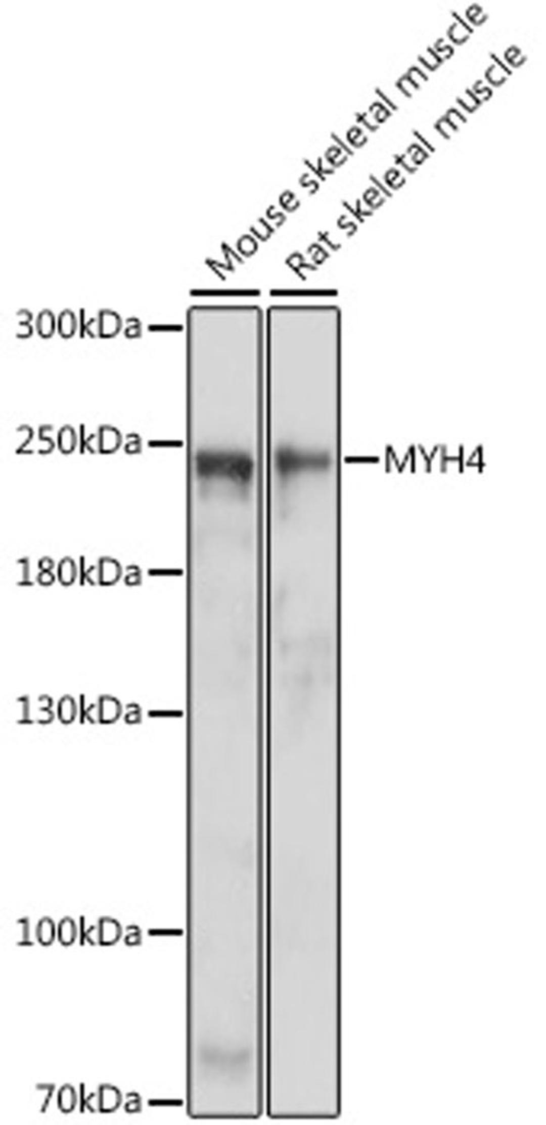 Western blot - MYH4 antibody (A15293)