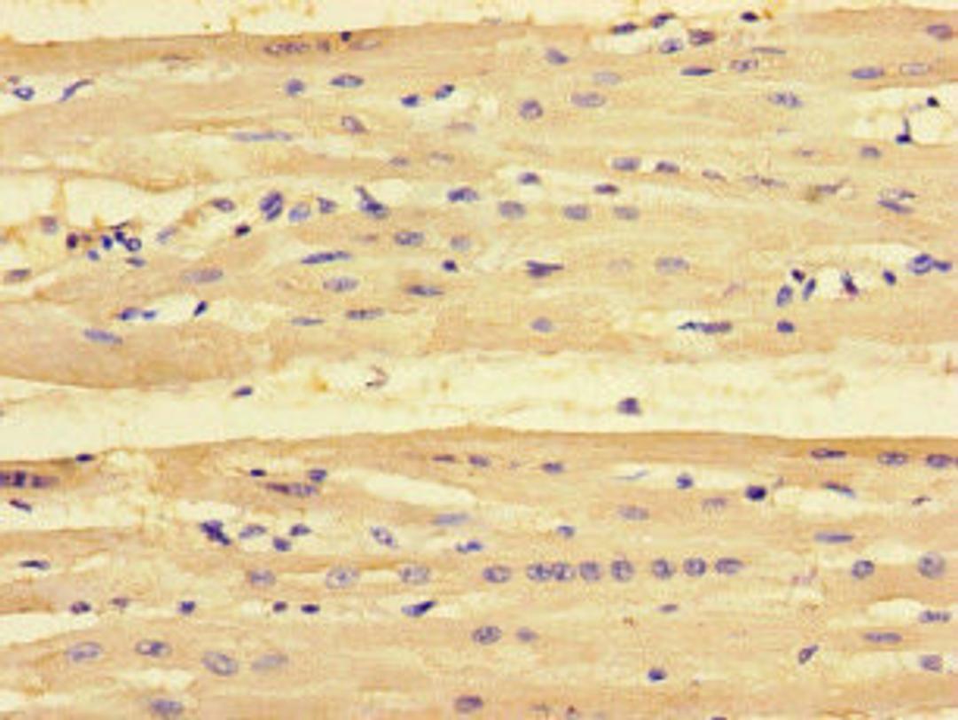 Immunohistochemistry of paraffin-embedded human heart tissue using CSB-PA018229LA01HU at dilution of 1:100