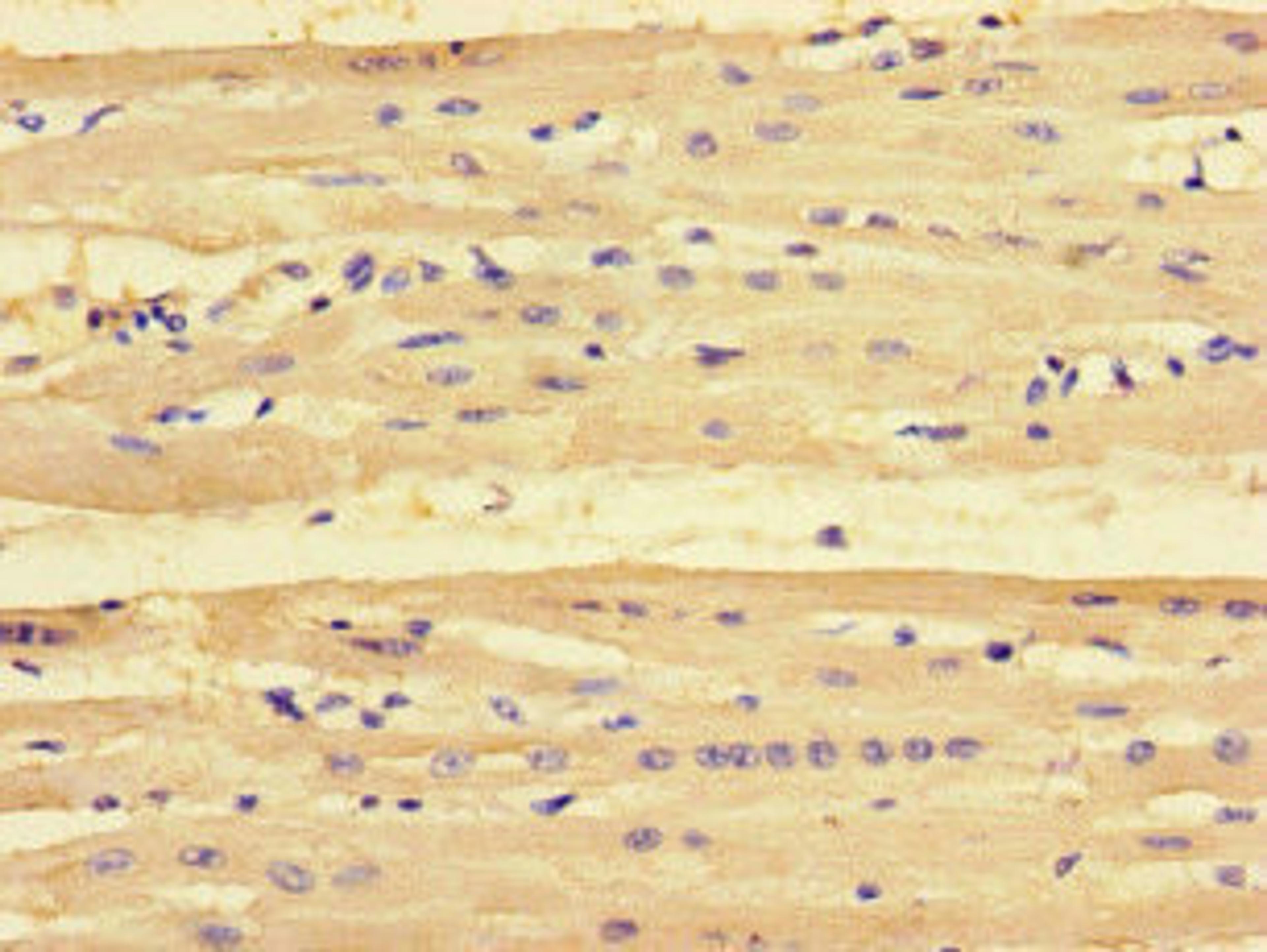 Immunohistochemistry of paraffin-embedded human heart tissue using CSB-PA018229LA01HU at dilution of 1:100