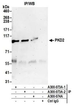 Detection of human PKD2 by western blot of immunoprecipitates.