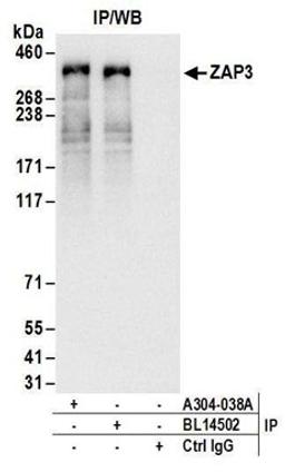 Detection of human ZAP3 by western blot of immunoprecipitates.