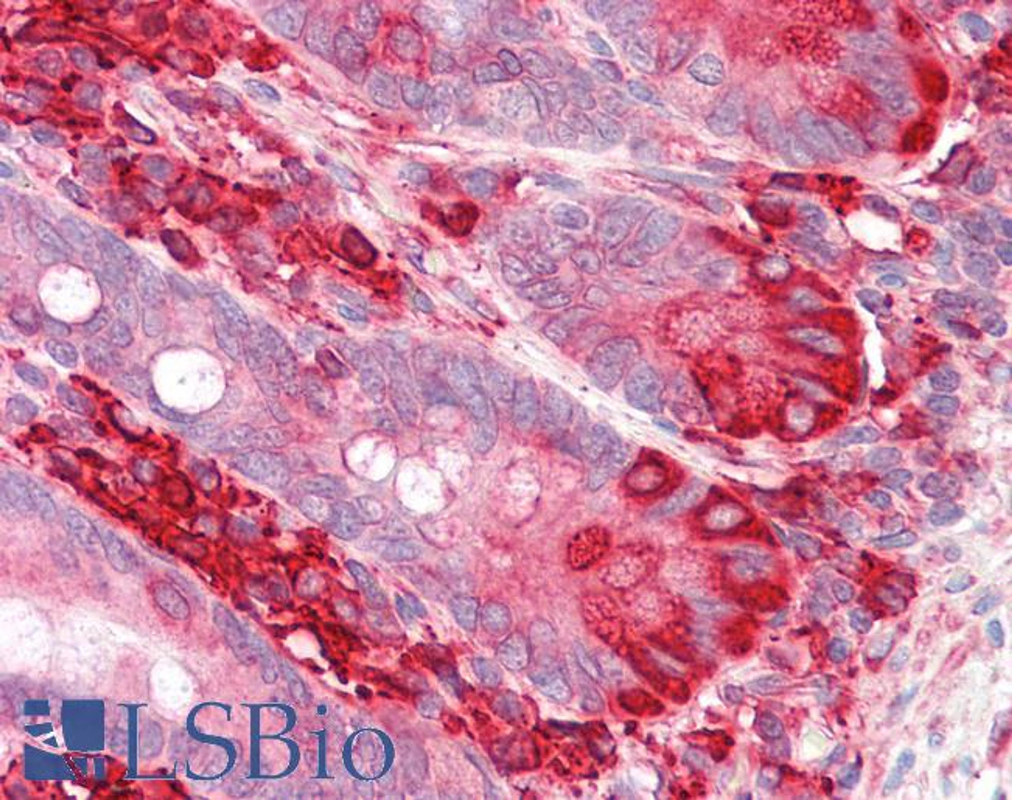 45-536 (3.75ug/ml) staining of paraffin embedded Human Small Intestine. Steamed antigen retrieval with citrate buffer pH 6, AP-staining.