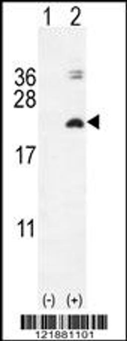 Western blot analysis of IL17F using rabbit polyclonal IL17F Antibody using 293 cell lysates (2 ug/lane) either nontransfected (Lane 1) or transiently transfected with the IL17F gene (Lane 2).