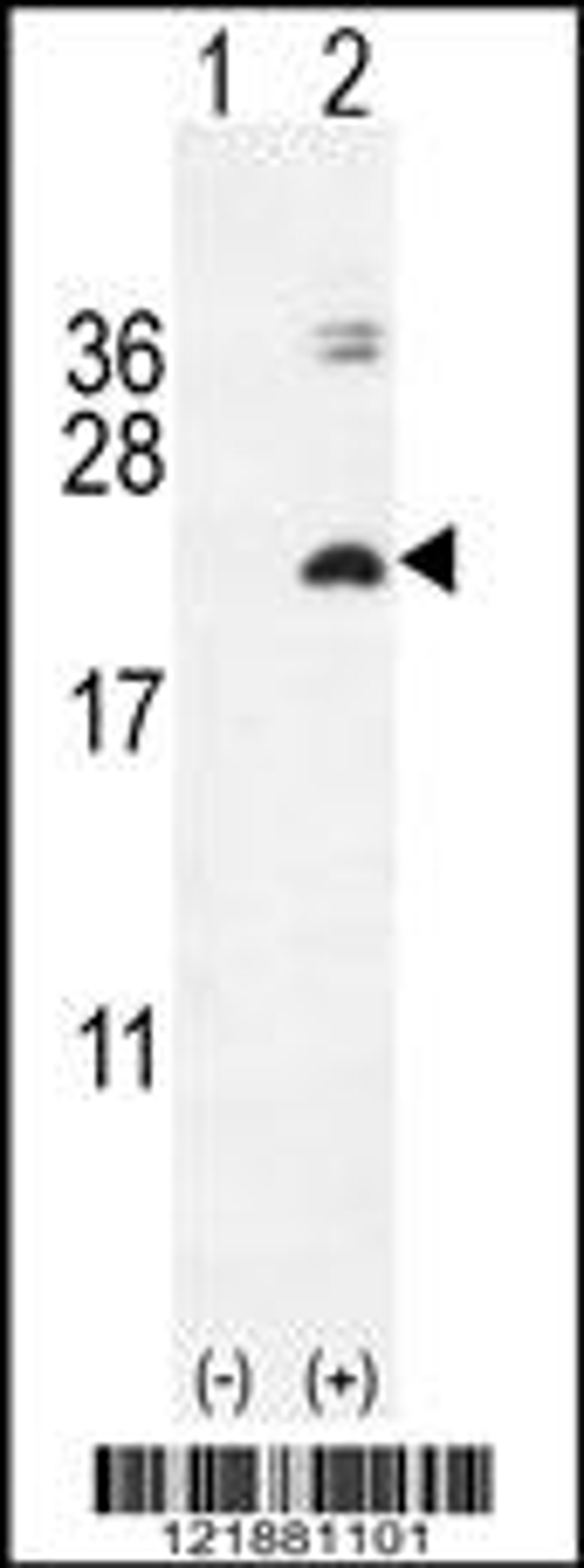 Western blot analysis of IL17F using rabbit polyclonal IL17F Antibody using 293 cell lysates (2 ug/lane) either nontransfected (Lane 1) or transiently transfected with the IL17F gene (Lane 2).