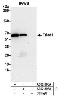 Detection of human Triad1 by western blot of Immunoprecipitates.