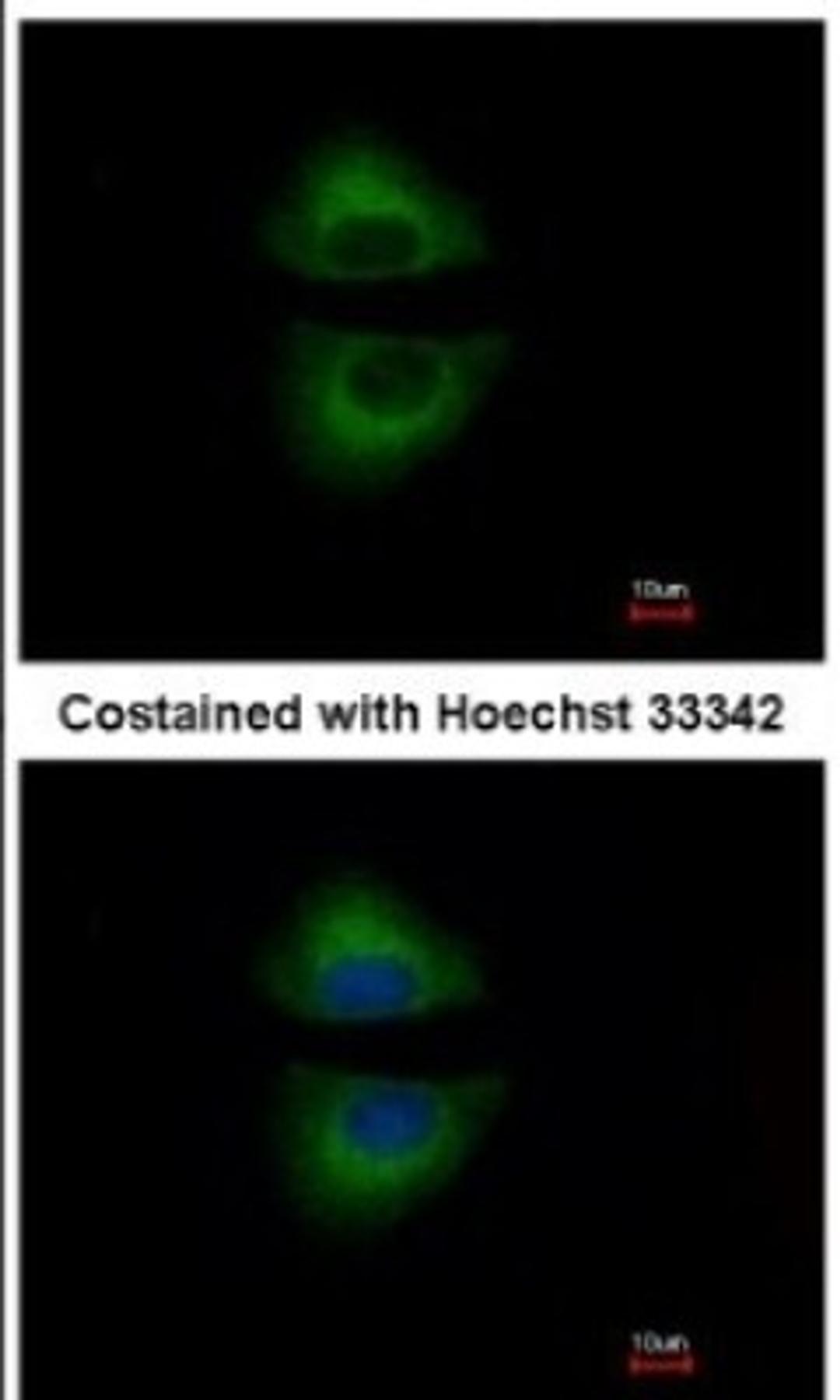 Immunocytochemistry/Immunofluorescence: GRAP Antibody [NBP1-33626] - Analysis of methanol-fixed A549, using antibody at 1:500 dilution.