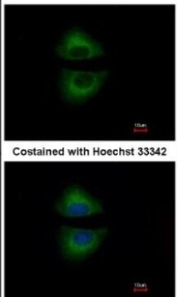 Immunocytochemistry/Immunofluorescence: GRAP Antibody [NBP1-33626] - Analysis of methanol-fixed A549, using antibody at 1:500 dilution.