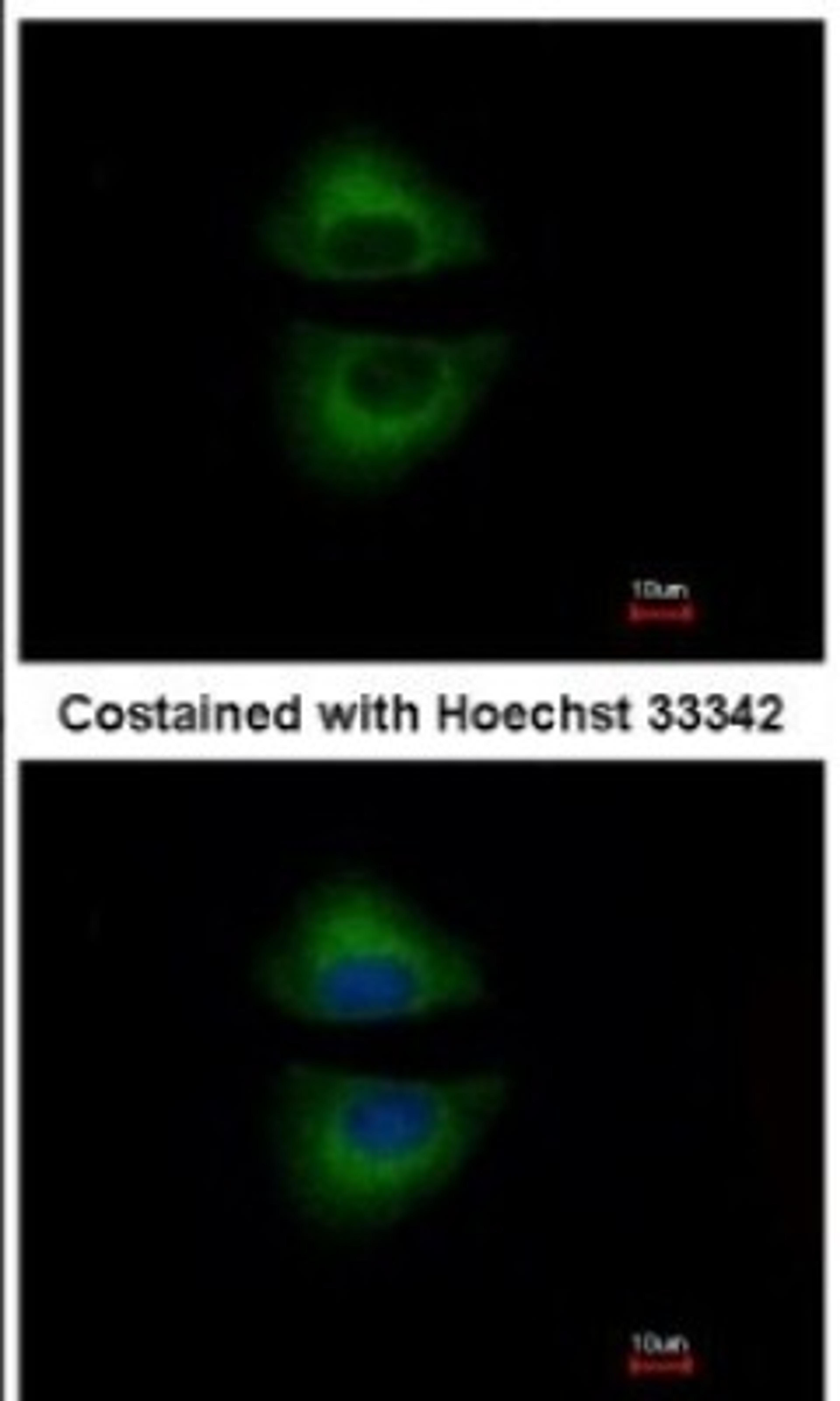 Immunocytochemistry/Immunofluorescence: GRAP Antibody [NBP1-33626] - Analysis of methanol-fixed A549, using antibody at 1:500 dilution.