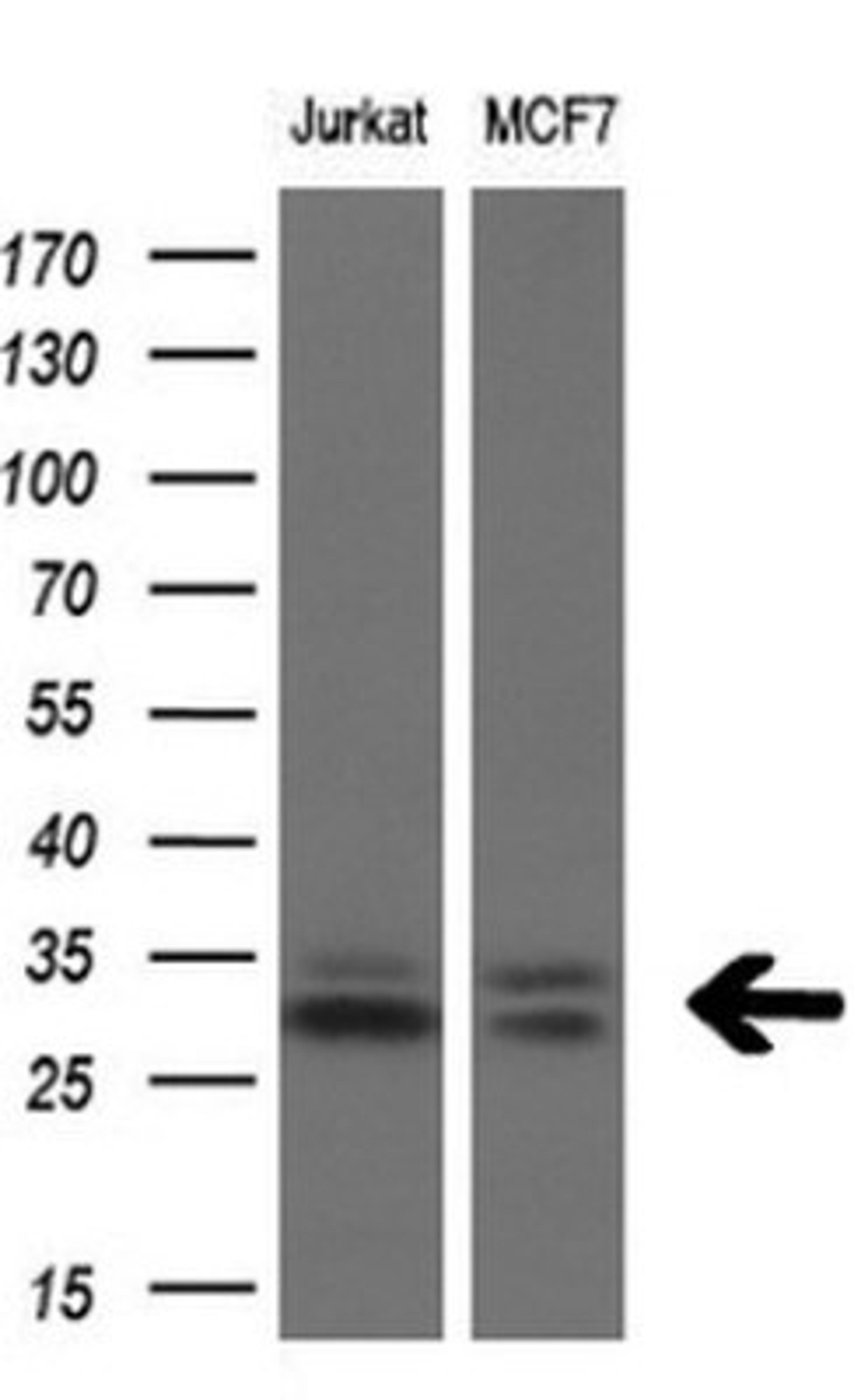 Western Blot: TGIF1 Antibody (1B12) [NBP2-46109] - Analysis of extracts (10ug) from 2 different cell lines.