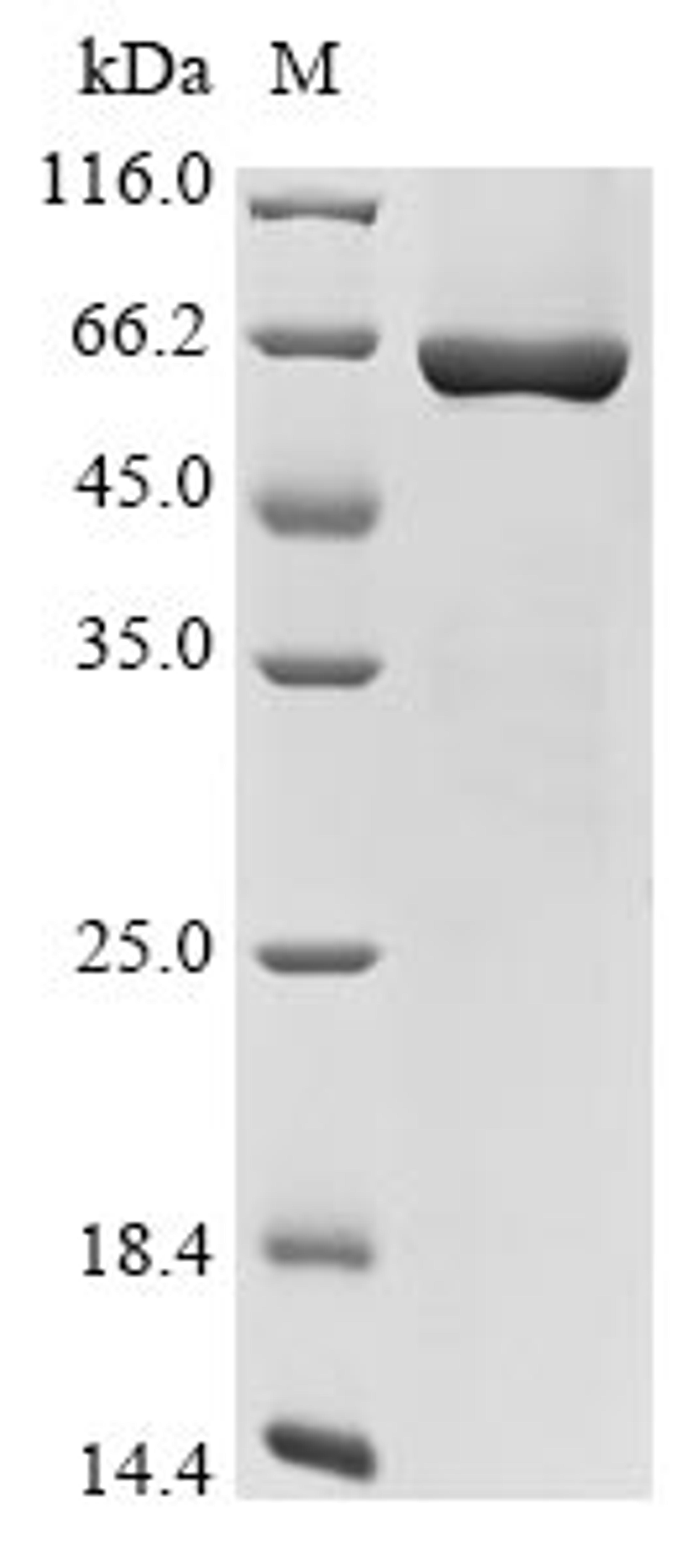 (Tris-Glycine gel) Discontinuous SDS-PAGE (reduced) with 5% enrichment gel and 15% separation gel.