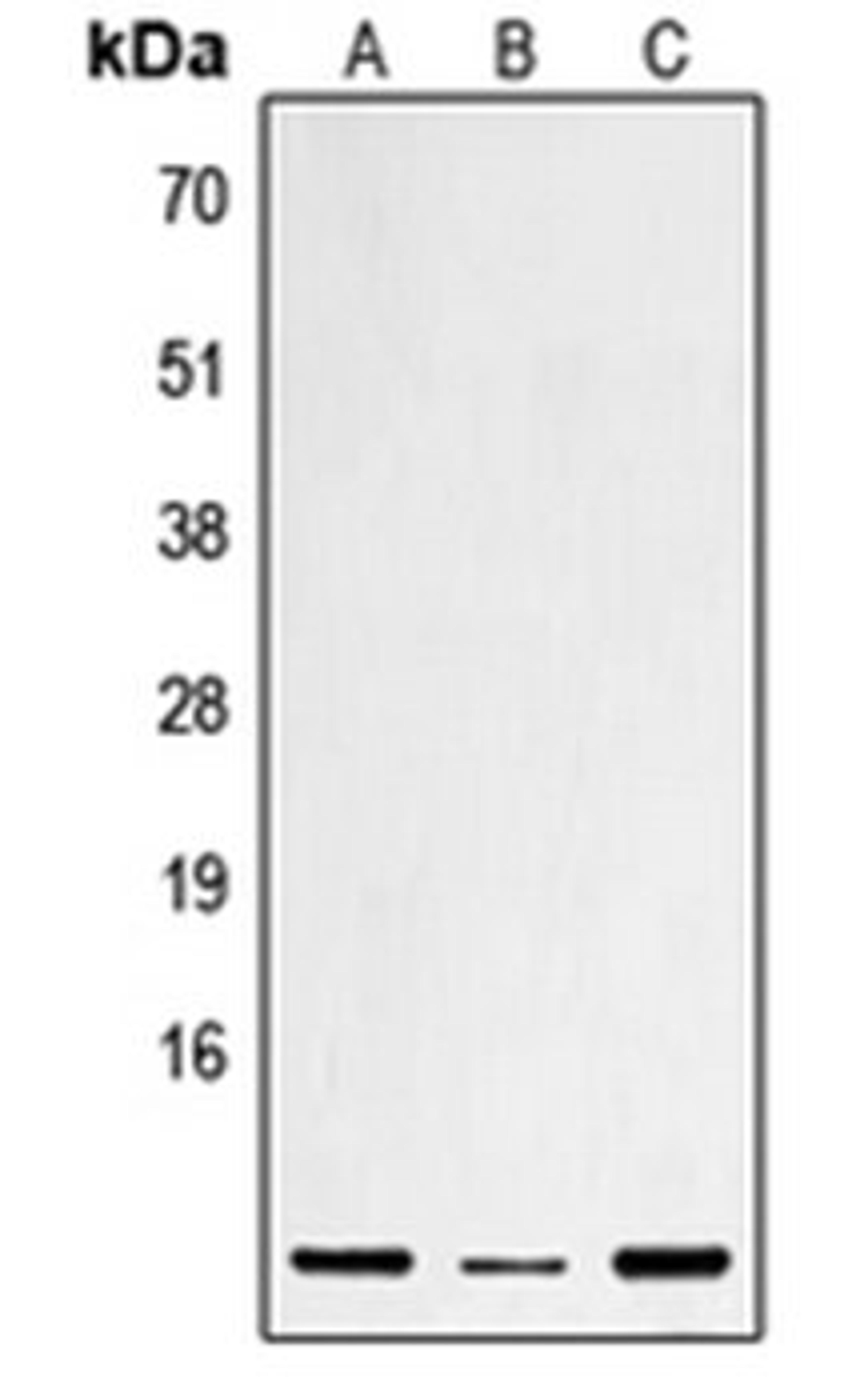 Western blot analysis of HEK293T (Lane 1), mouse liver (Lane 2), rat heart (Lane 3) whole cell lysates using DEFB1 antibody