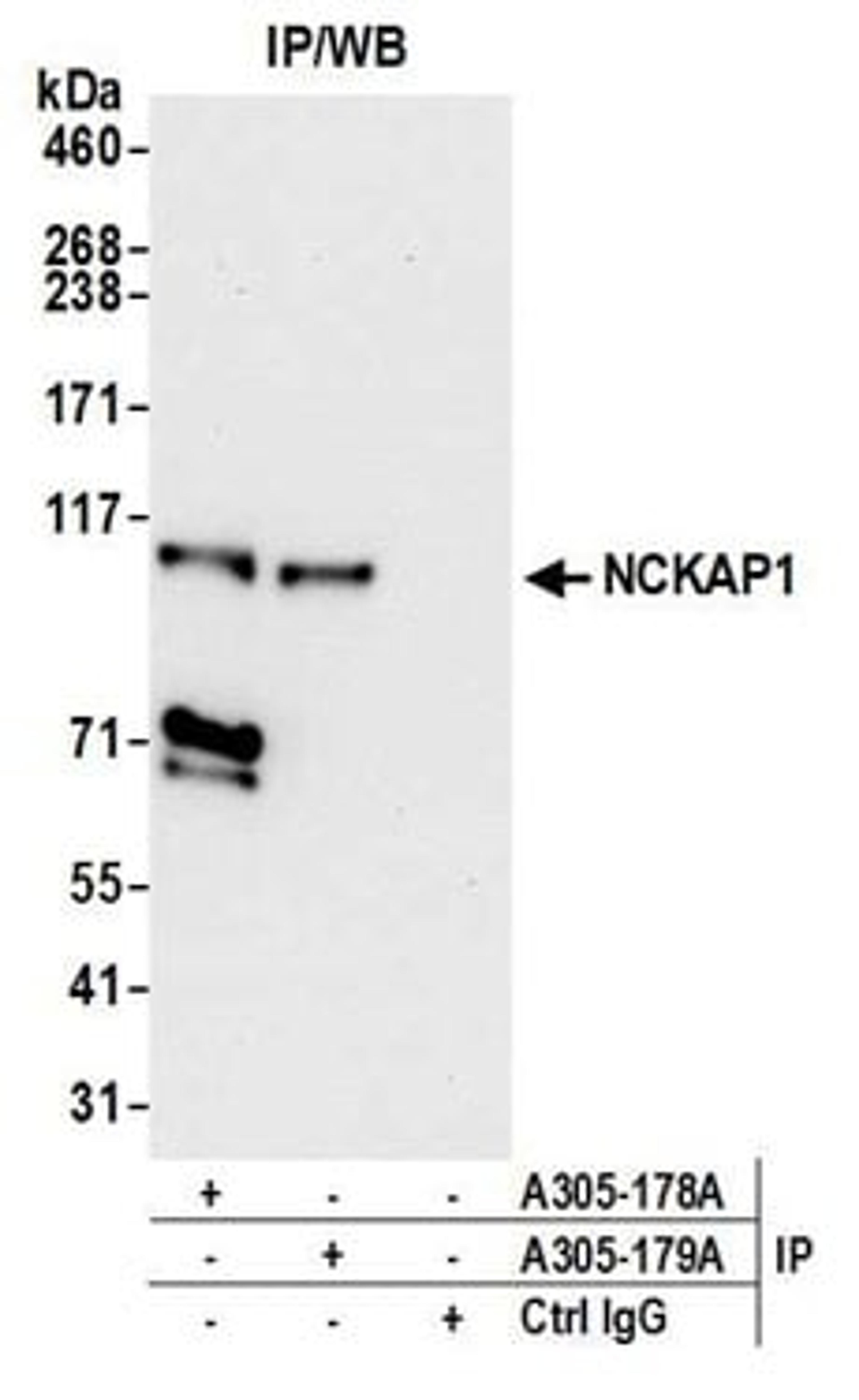 Detection of human NCKAP1 by western blot of immunoprecipitates.