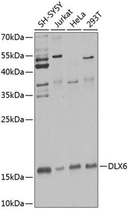 Western blot - DLX6 Antibody (A7667)