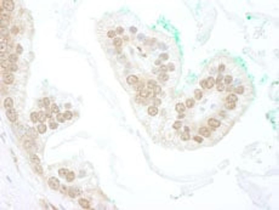 Detection of human BTBD12 by immunohistochemistry.