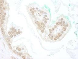 Detection of human BTBD12 by immunohistochemistry.