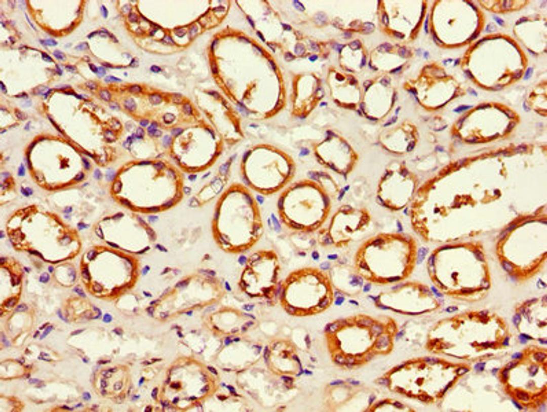 Immunohistochemistry of paraffin-embedded human kidney tissue using CSB-PA001899LA01HU at dilution of 1:100
