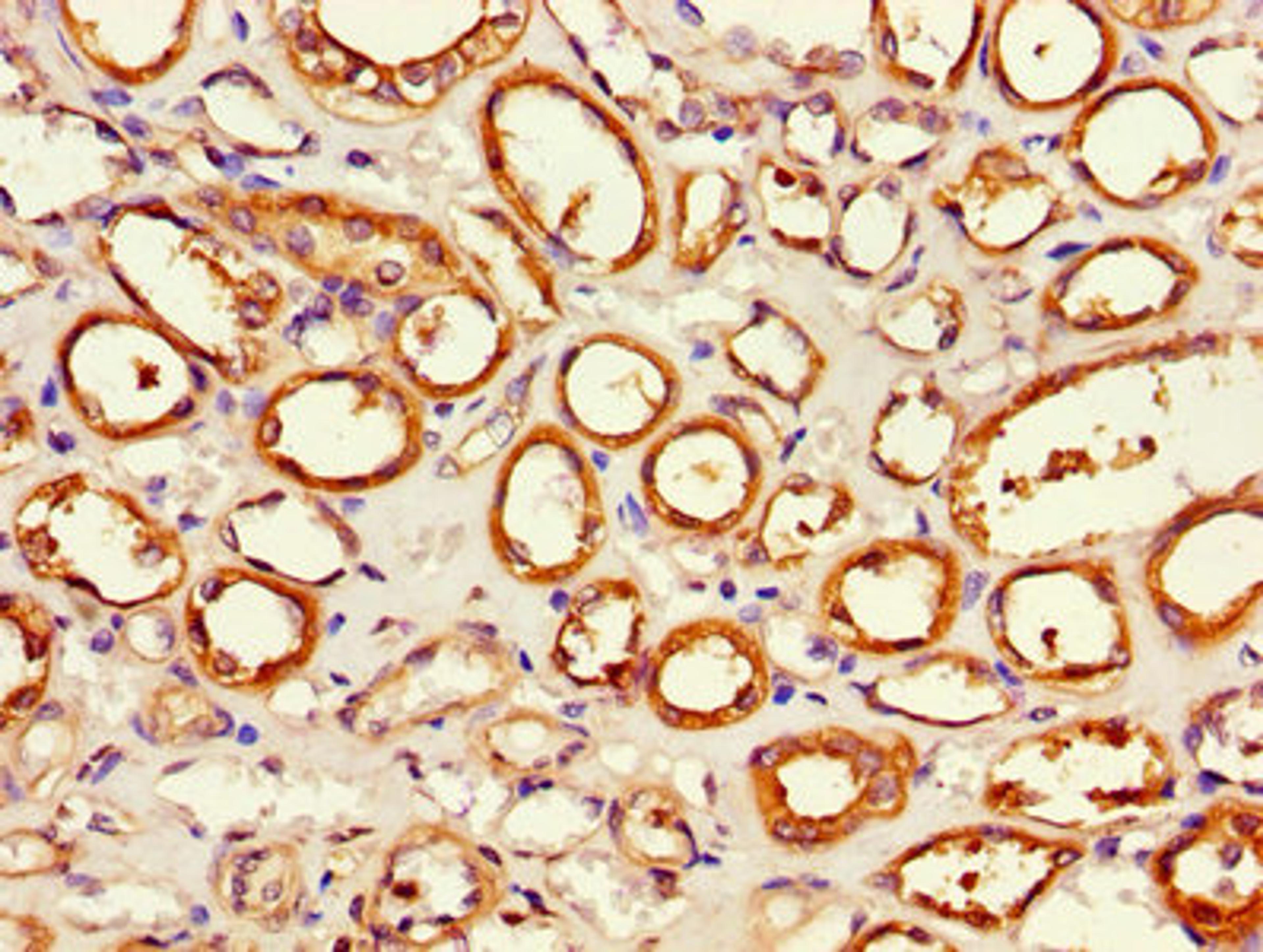 Immunohistochemistry of paraffin-embedded human kidney tissue using CSB-PA001899LA01HU at dilution of 1:100