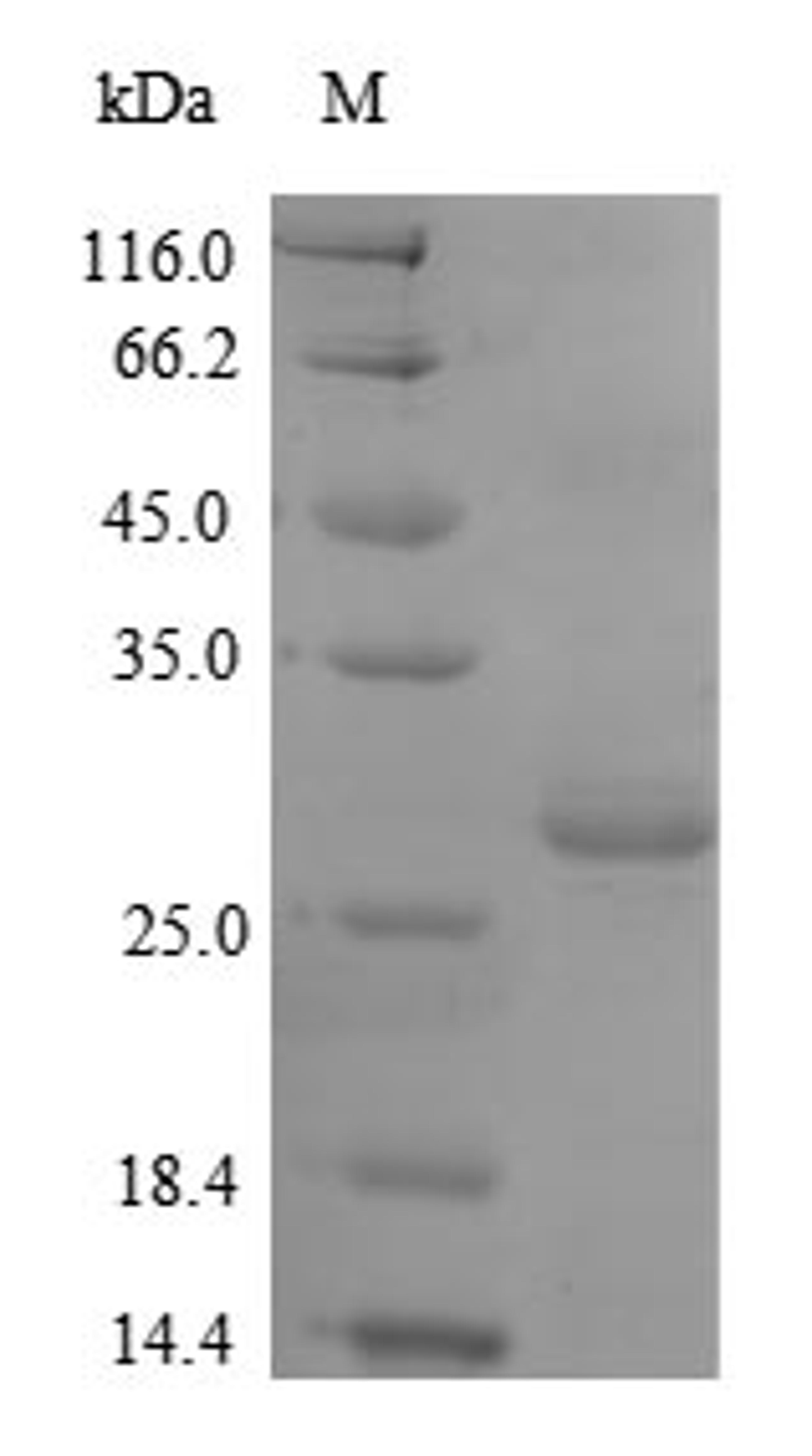 (Tris-Glycine gel) Discontinuous SDS-PAGE (reduced) with 5% enrichment gel and 15% separation gel.