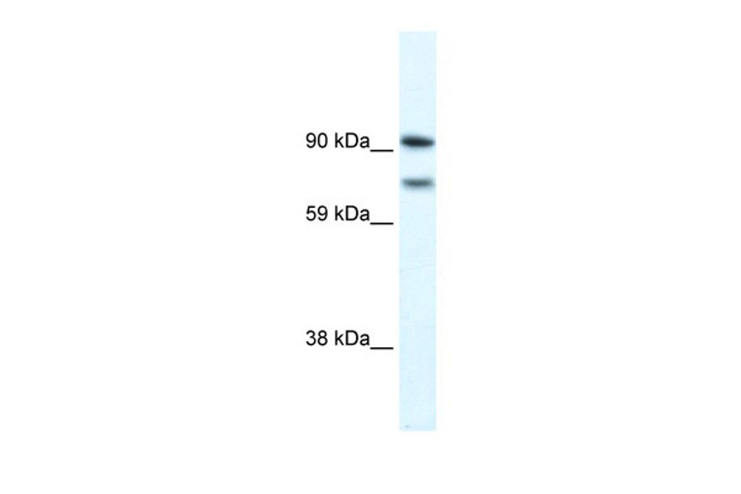 Antibody used in WB on Human brain at 0.2-1 ug/ml.