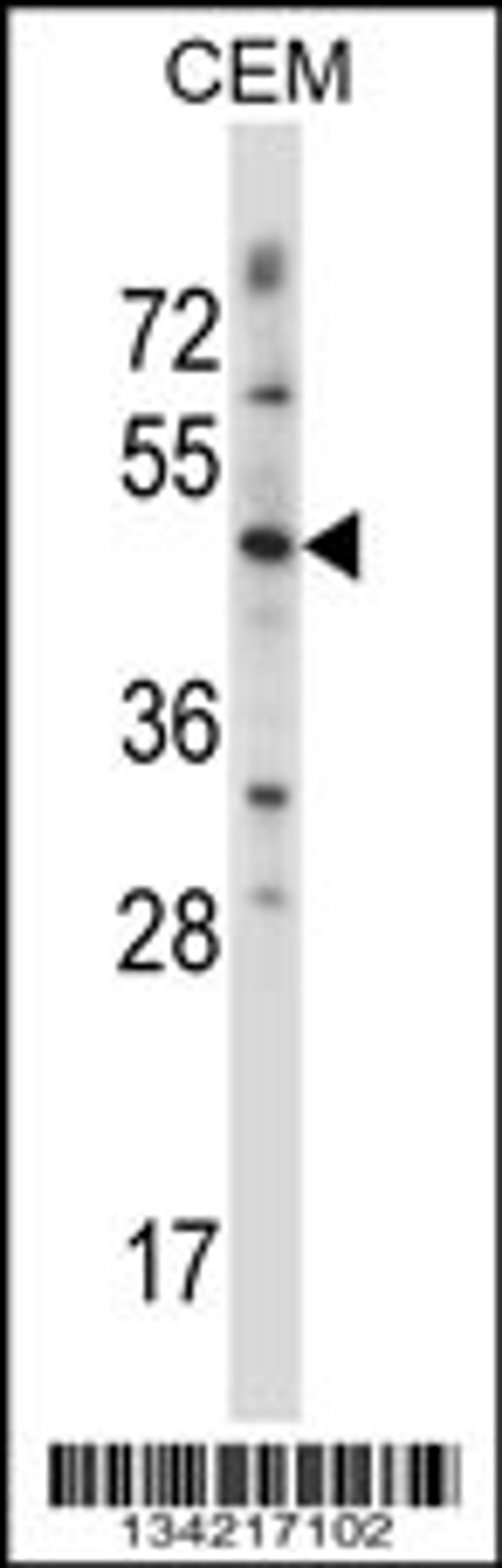 Western blot analysis in CEM cell line lysates (35ug/lane).