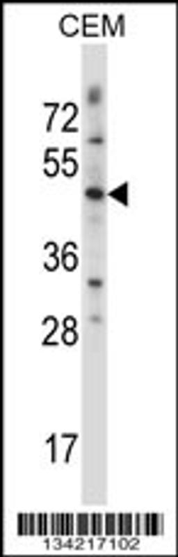 Western blot analysis in CEM cell line lysates (35ug/lane).