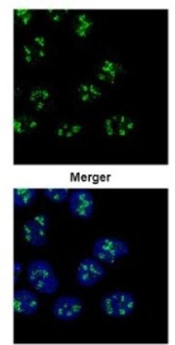 Immunocytochemistry/Immunofluorescence: PAF49 Antibody [NBP2-19676] - Confocal immunofluorescence analysis of paraformaldehyde-fixed A431, using PAF49 antibody (Green) at 1:500 dilution.