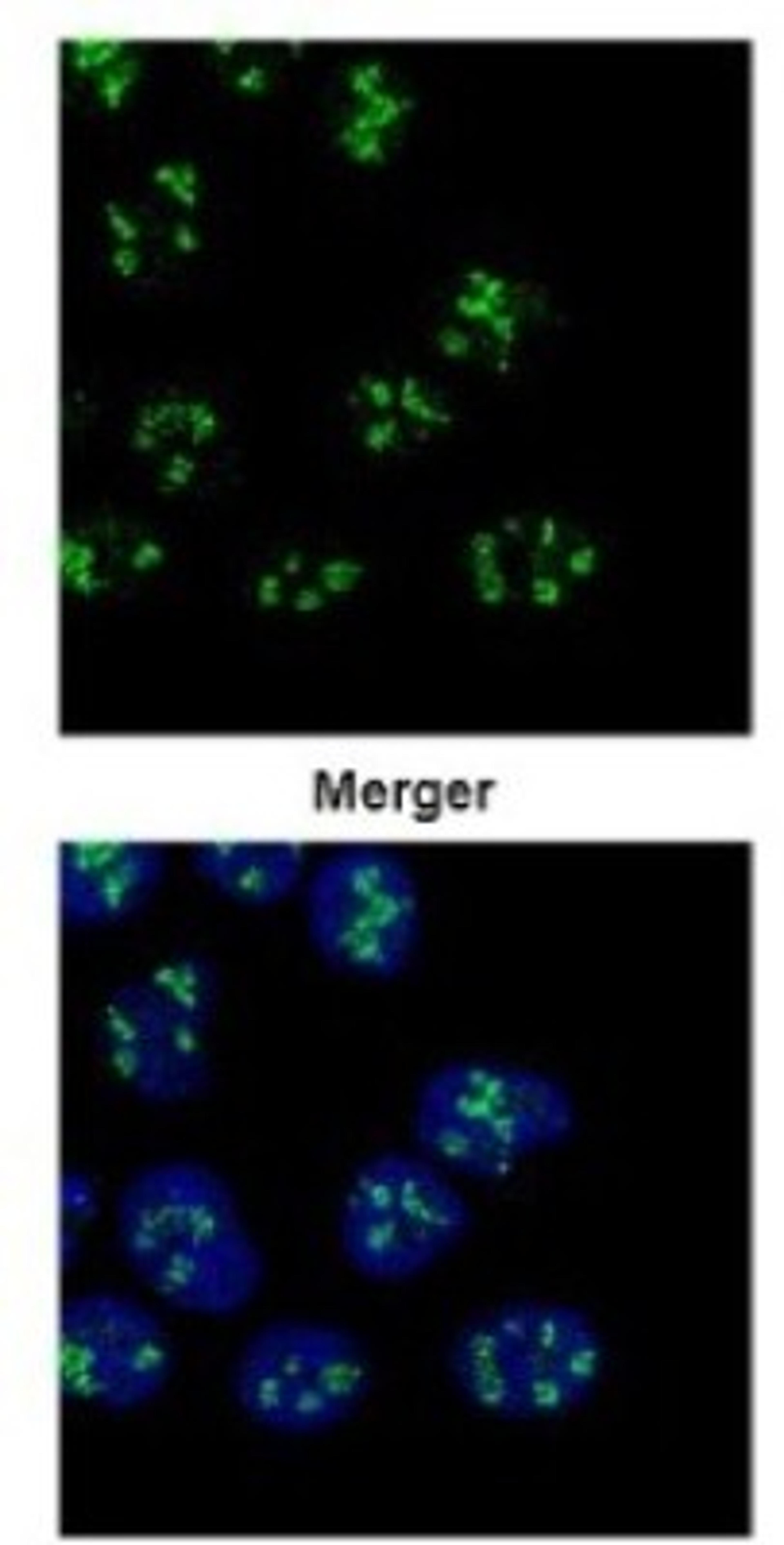 Immunocytochemistry/Immunofluorescence: PAF49 Antibody [NBP2-19676] - Confocal immunofluorescence analysis of paraformaldehyde-fixed A431, using PAF49 antibody (Green) at 1:500 dilution.