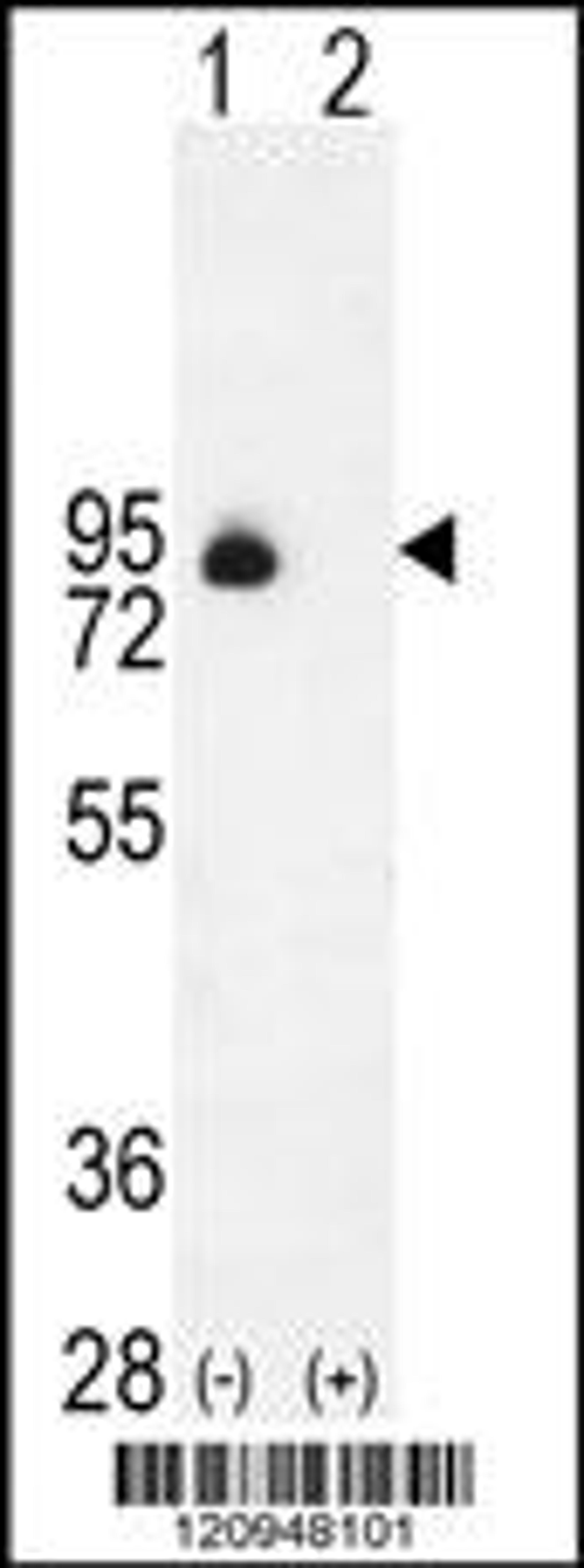 Western blot analysis of ENG using rabbit polyclonal ENG Antibody using 293 cell lysates (2 ug/lane) either nontransfected (Lane 1) or transiently transfected (Lane 2) with the ENG gene.