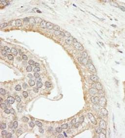 Detection of human ABCF2 by immunohistochemistry.