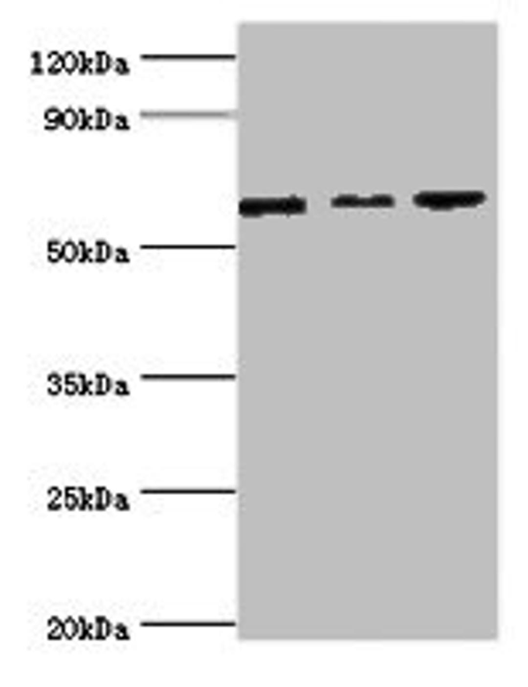 Western blot. All lanes: MAPK4 ntibody at 6ug/ml. Lane 1: Mouse brain tissue. Lane 2: 293T whole cell lysate. Lane 3: Jurkat whole cell lysate. Secondary. Goat polyclonal to rabbit IgG at 1/10000 dilution. Predicted band size: 66 kDa. Observed band size: 66 kDa.