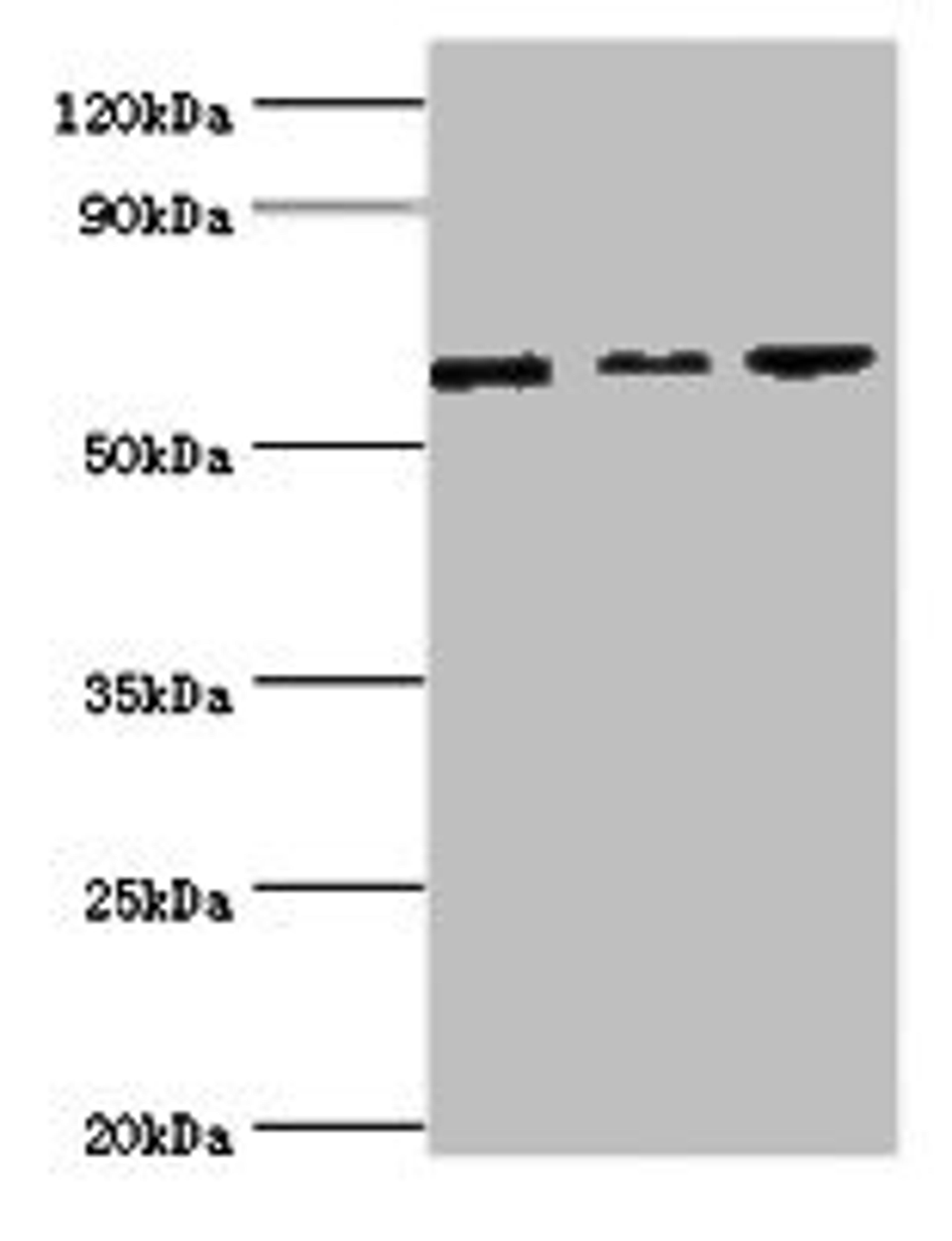 Western blot. All lanes: MAPK4 ntibody at 6ug/ml. Lane 1: Mouse brain tissue. Lane 2: 293T whole cell lysate. Lane 3: Jurkat whole cell lysate. Secondary. Goat polyclonal to rabbit IgG at 1/10000 dilution. Predicted band size: 66 kDa. Observed band size: 66 kDa.