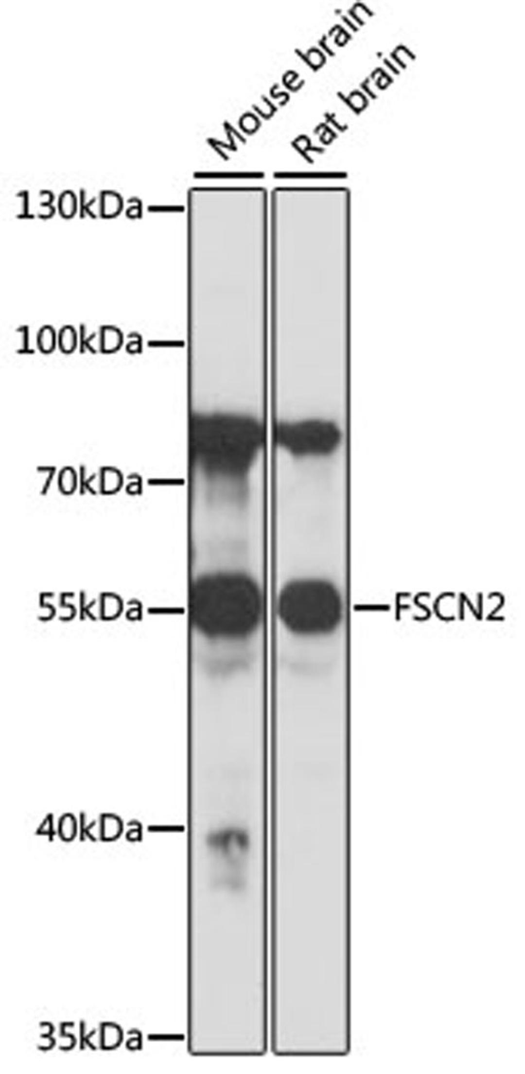 Western blot - FSCN2 antibody (A16508)