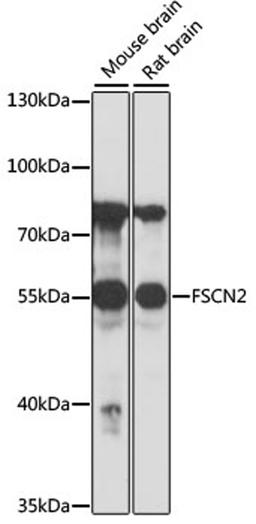 Western blot - FSCN2 antibody (A16508)