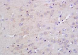 Immunohistochemical analysis of formalin-fixed paraffin embedded mouse pancreas tissue using KCNN3 antibody (dilution at 1:200)