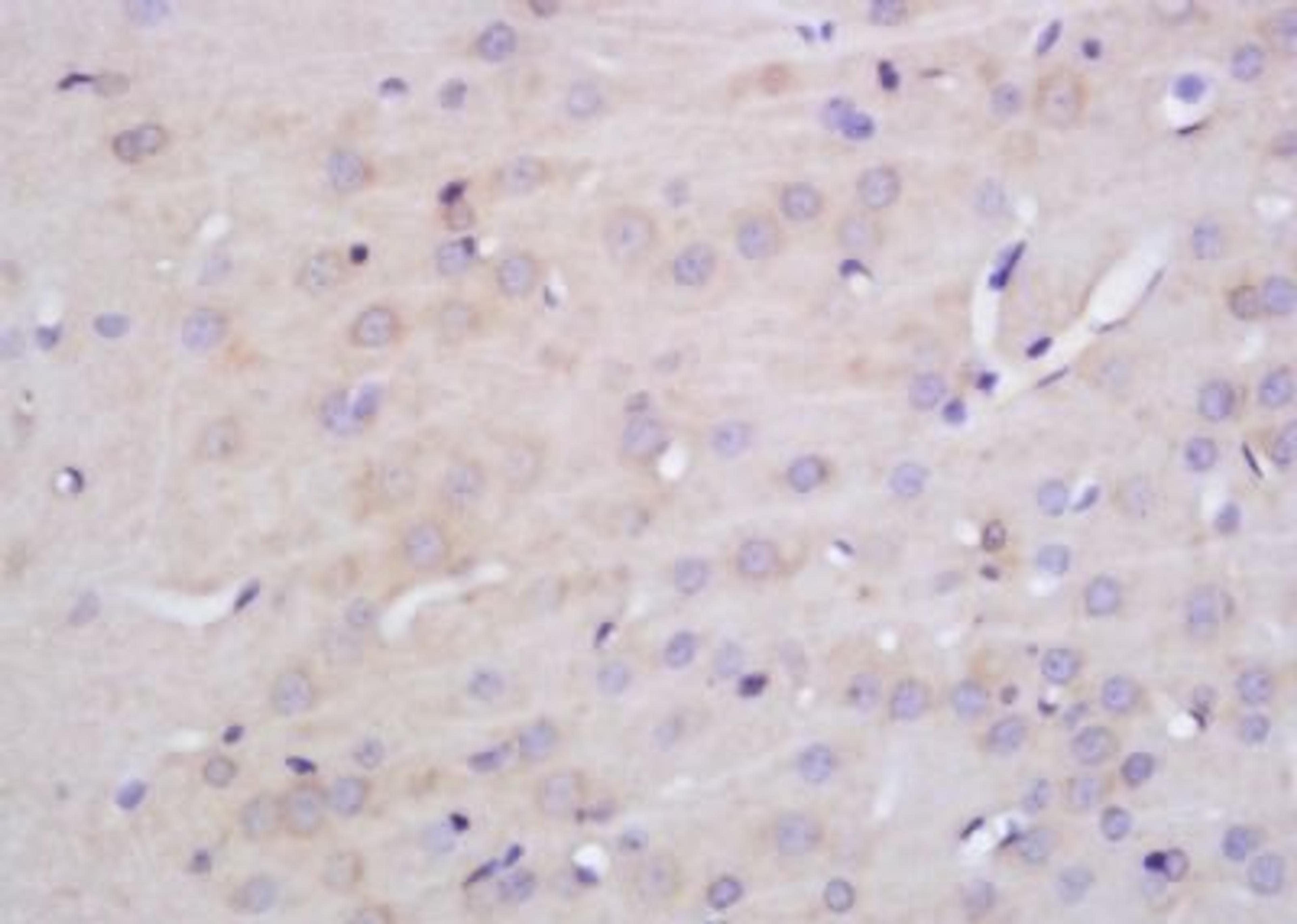 Immunohistochemical analysis of formalin-fixed paraffin embedded mouse pancreas tissue using KCNN3 antibody (dilution at 1:200)