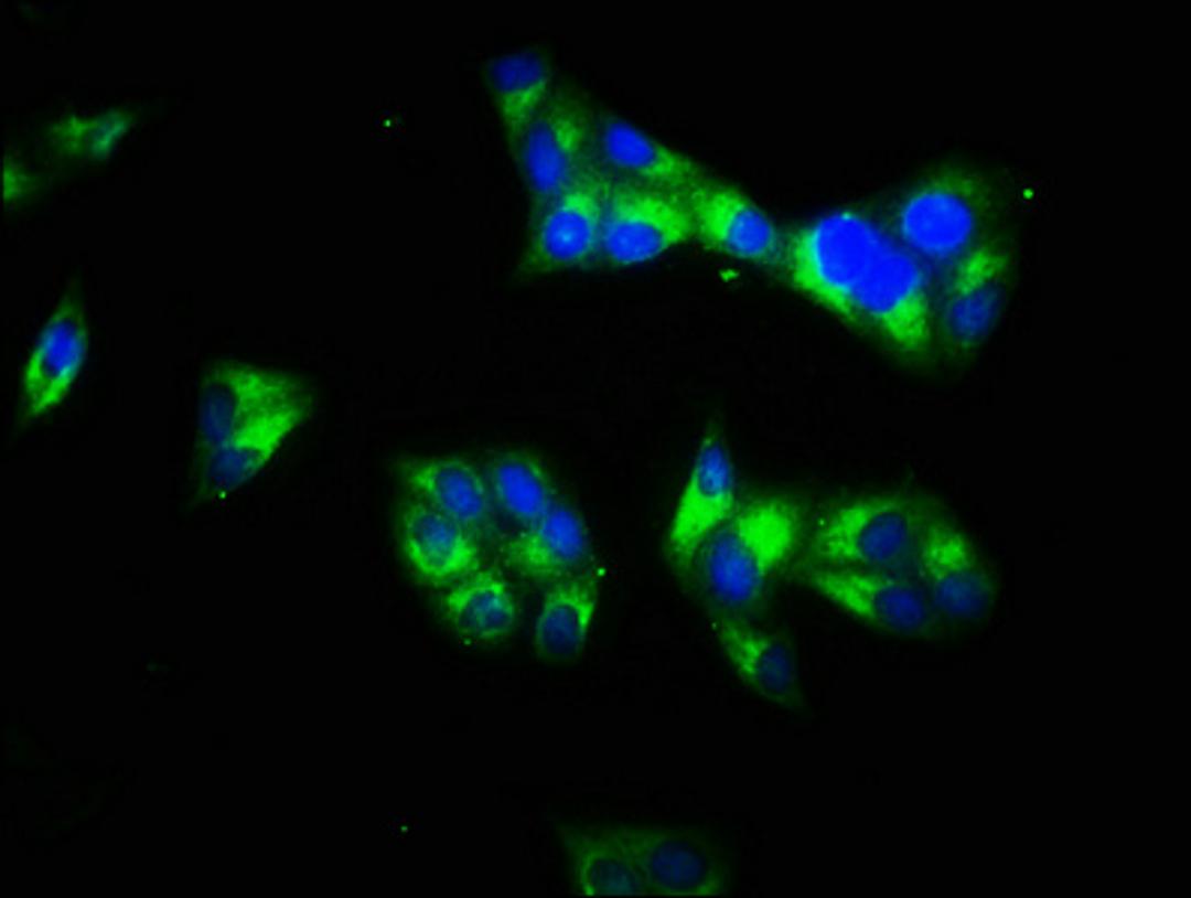 Immunofluorescence staining of Hela cells with CSB-PA11477A0Rb at 1:66, counter-stained with DAPI. The cells were fixed in 4% formaldehyde, permeabilized using 0.2% Triton X-100 and blocked in 10% normal Goat Serum. The cells were then incubated with the antibody overnight at 4°C. The secondary antibody was Alexa Fluor 488-congugated AffiniPure Goat Anti-Rabbit IgG(H+L).