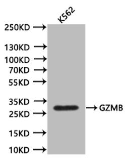 Western BlotPositive WB detected in:K562 whole cell lysate (20µg)All lanes: GZMB antibody at 1:1000SecondaryGoat polyclonal to mouse IgG at 1/50000 dilutionPredicted band size:27.7 kDaObserved band size:28 kDaExposure time:300s