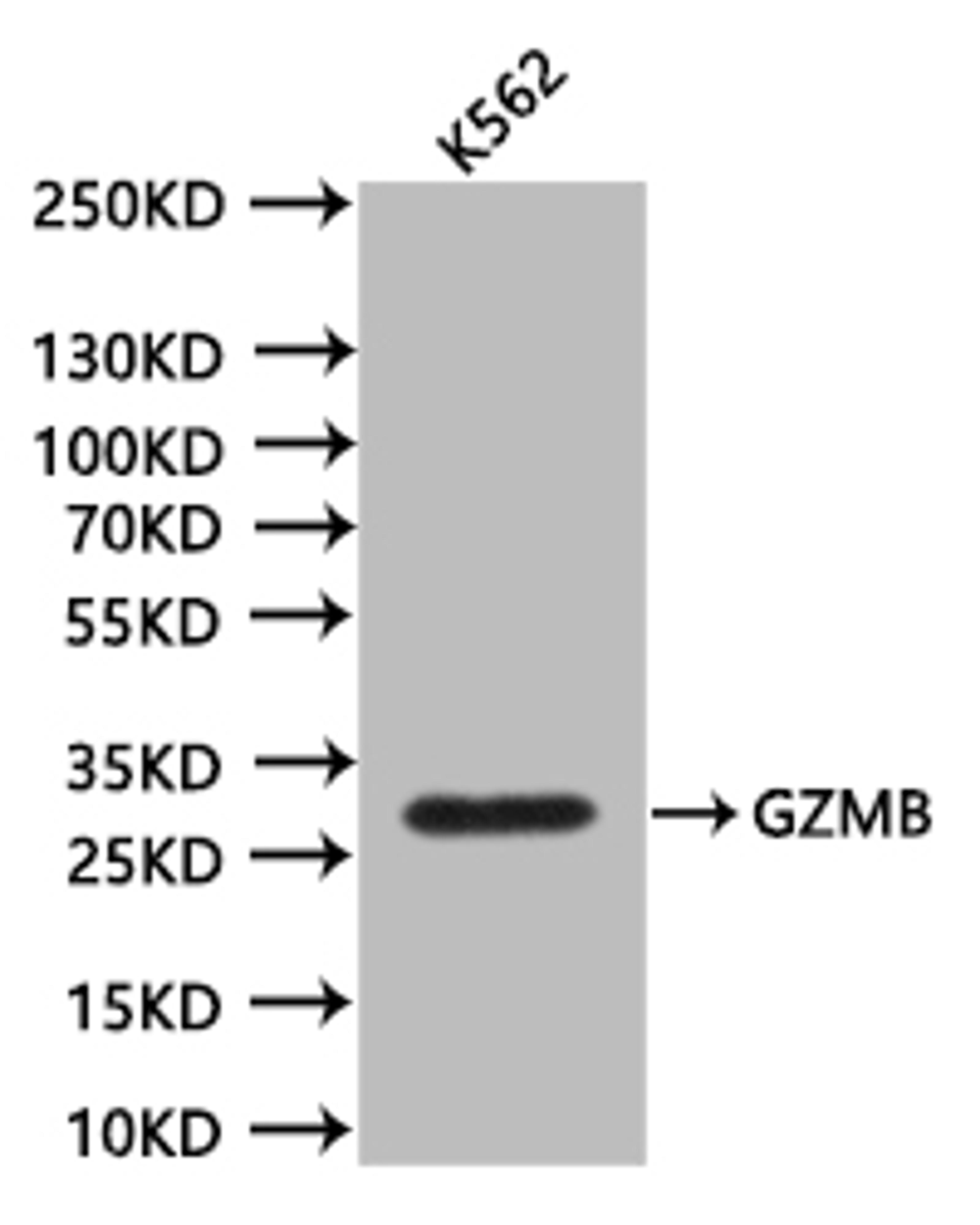 Western BlotPositive WB detected in:K562 whole cell lysate (20µg)All lanes: GZMB antibody at 1:1000SecondaryGoat polyclonal to mouse IgG at 1/50000 dilutionPredicted band size:27.7 kDaObserved band size:28 kDaExposure time:300s