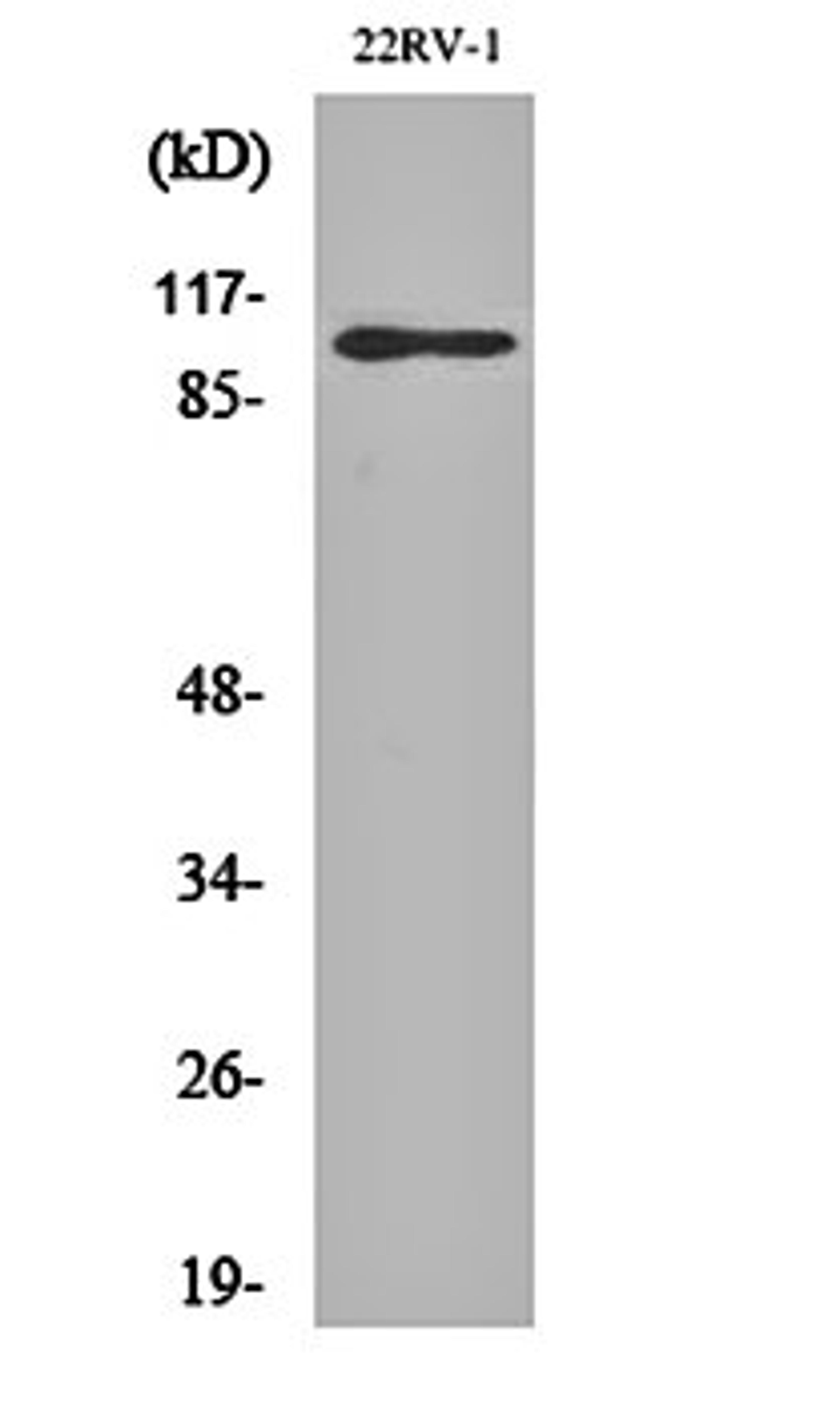 Western blot analysis of 22RV-1 cell lysates using GluR-2 antibody