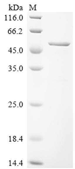(Tris-Glycine gel) Discontinuous SDS-PAGE (reduced) with 5% enrichment gel and 15% separation gel.