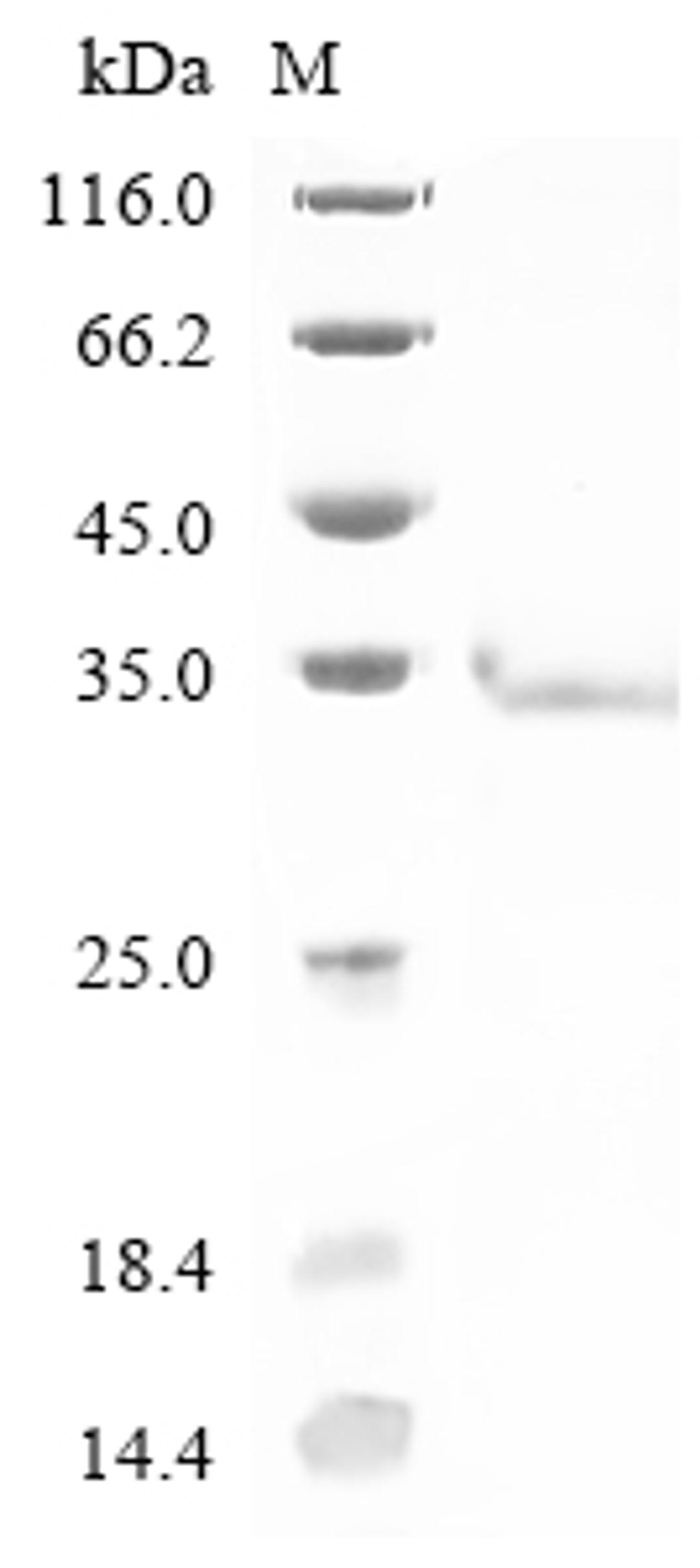 (Tris-Glycine gel) Discontinuous SDS-PAGE (reduced) with 5% enrichment gel and 15% separation gel.
