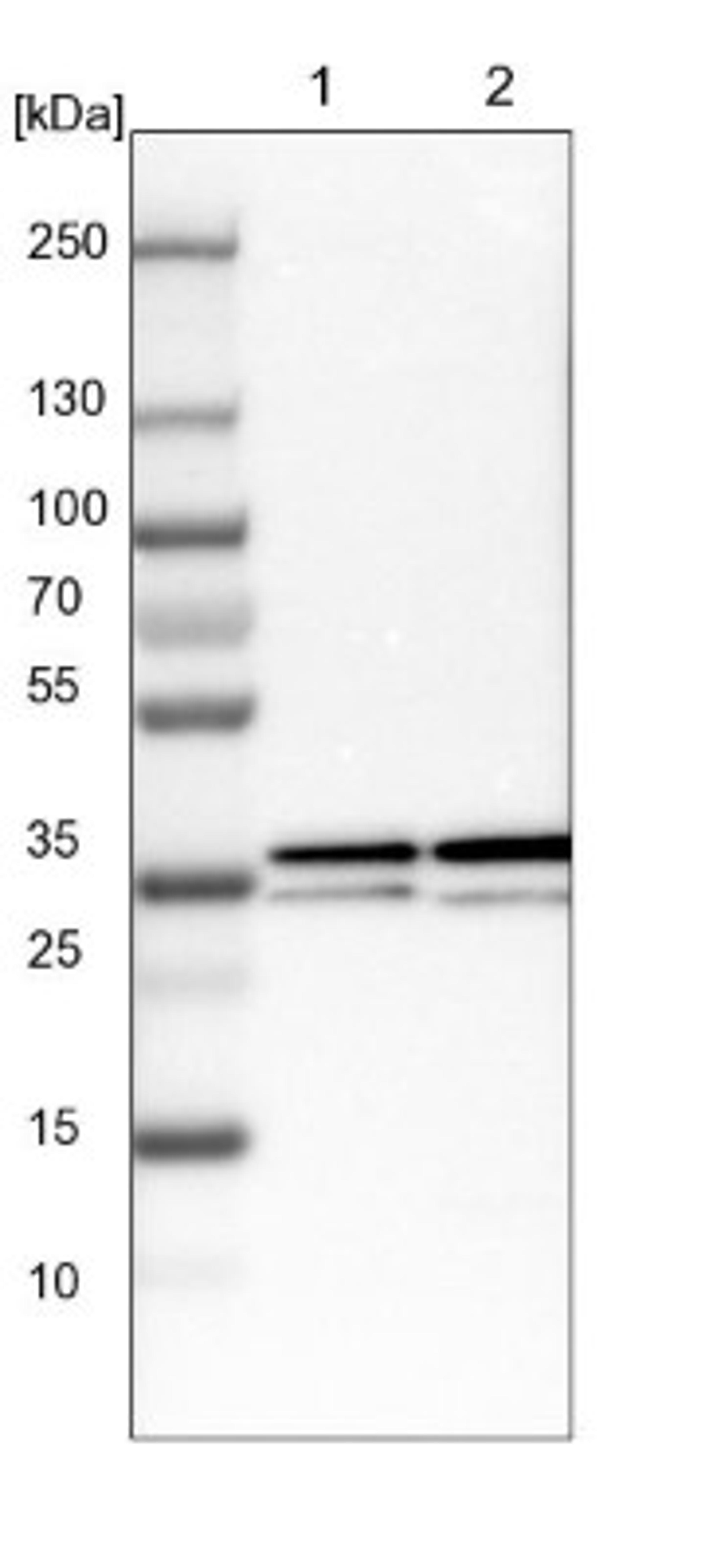 Western Blot: TFAP2D Antibody [NBP2-13428] - Lane 1: NIH-3T3 cell lysate (Mouse embryonic fibroblast cells)<br/>Lane 2: NBT-II cell lysate (Rat Wistar bladder tumour cells)